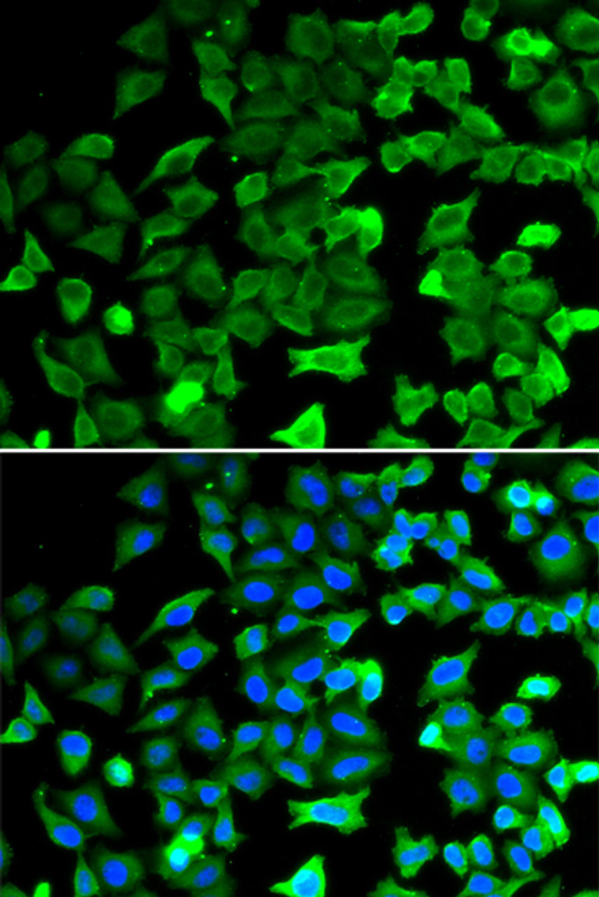 Immunofluorescence analysis of HeLa cells using SIRT2 Polyclonal Antibody