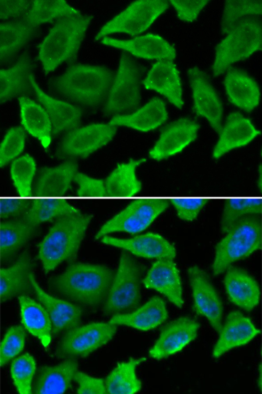 Immunofluorescence analysis of A549 cells using IFNA1 Polyclonal Antibody