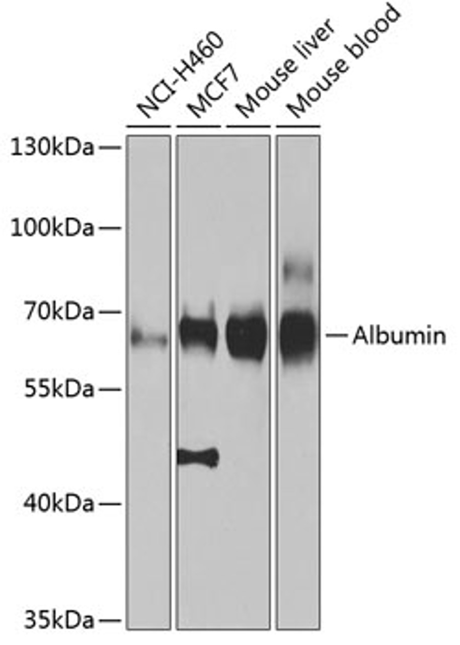 Western blot analysis of extracts of various cell lines using Albumin Polyclonal Antibody at dilution of 1:1000.