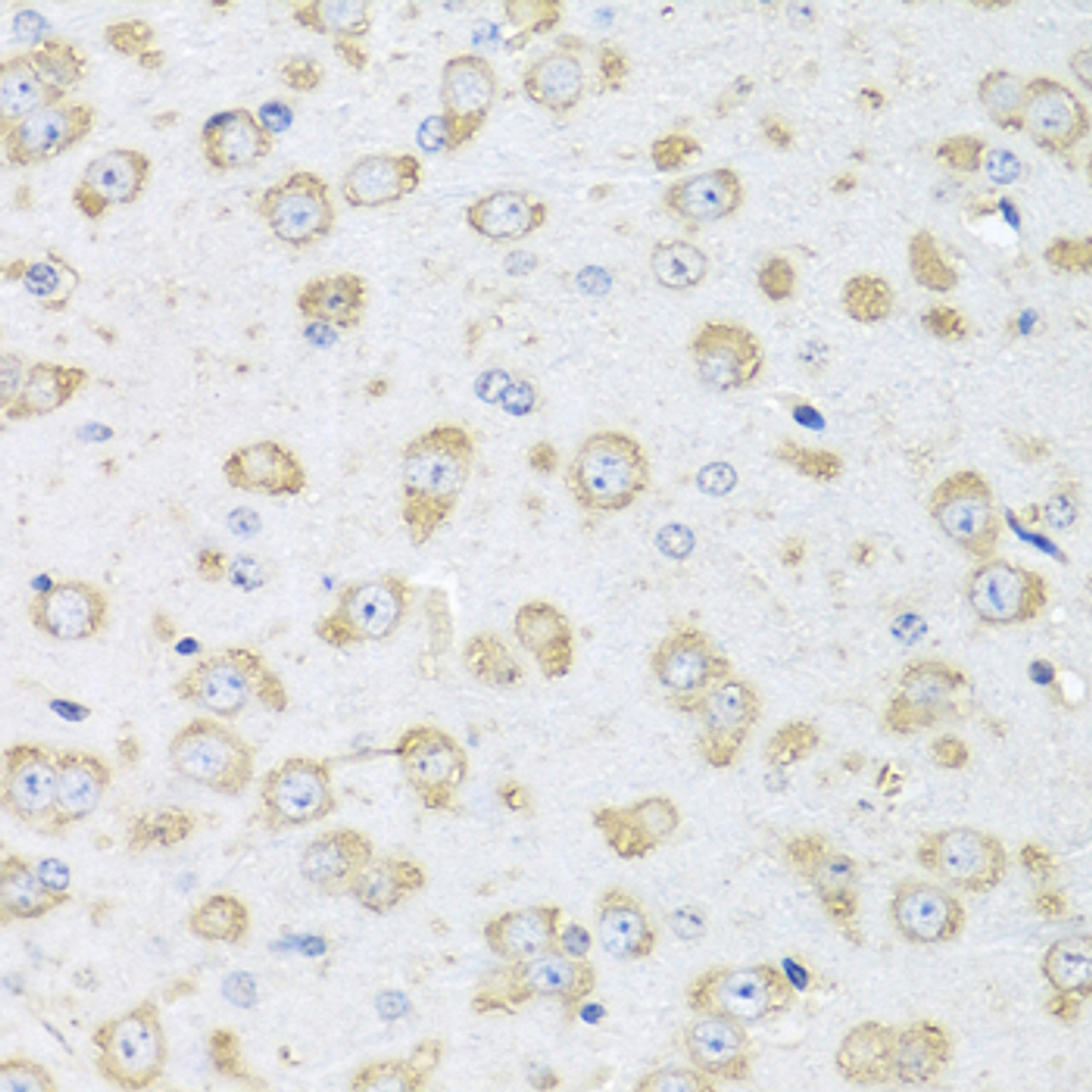 Immunohistochemistry of paraffin-embedded Mouse brain using Albumin Polyclonal Antibody at dilution of  1:100 (40x lens).