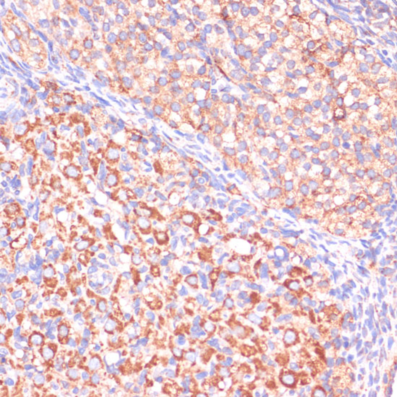 Immunohistochemistry of paraffin-embedded Rat ovary using VHL Polyclonal Antibody at dilution of  1:200 (40x lens).