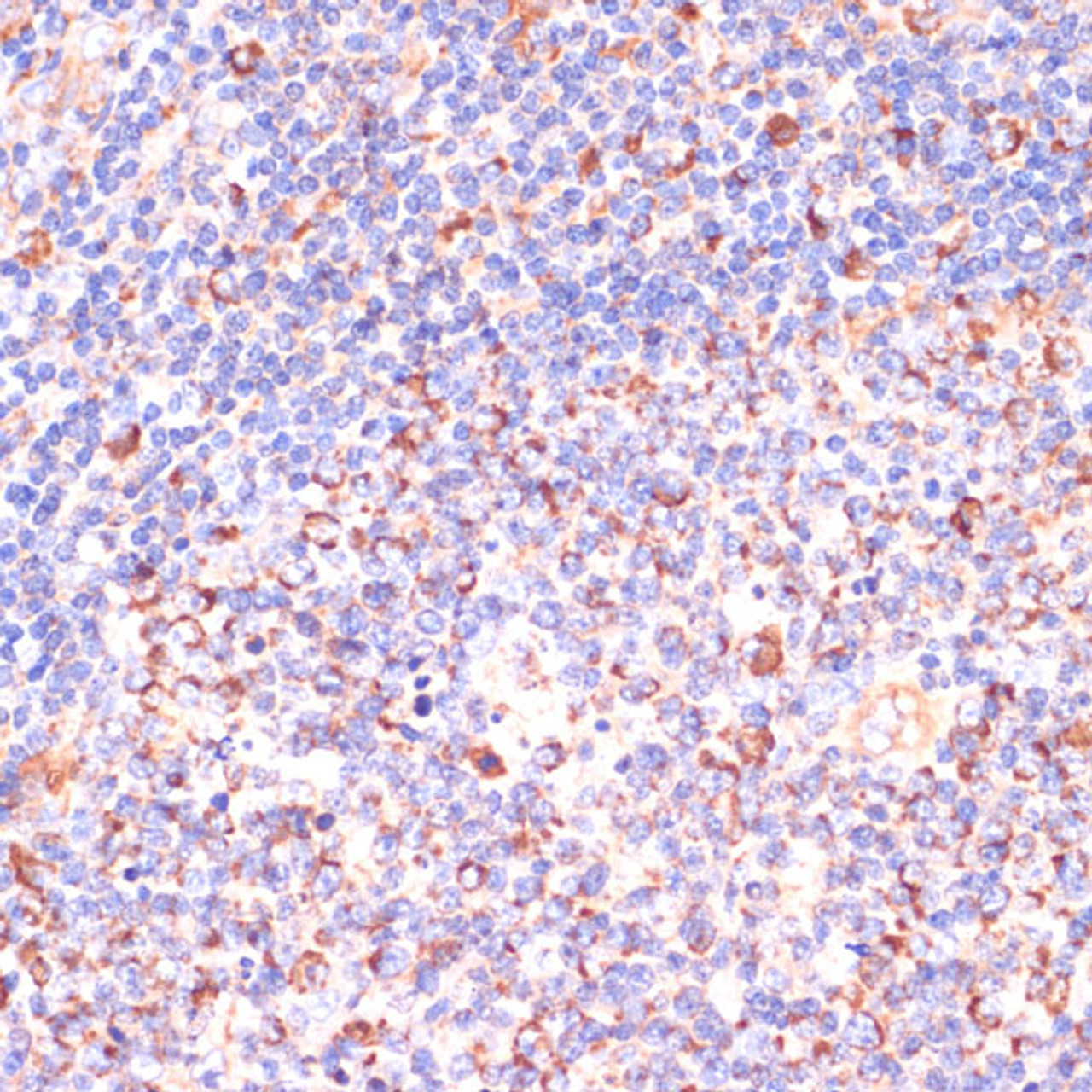 Immunohistochemistry of paraffin-embedded Human tonsil using VHL Polyclonal Antibody at dilution of  1:200 (40x lens).