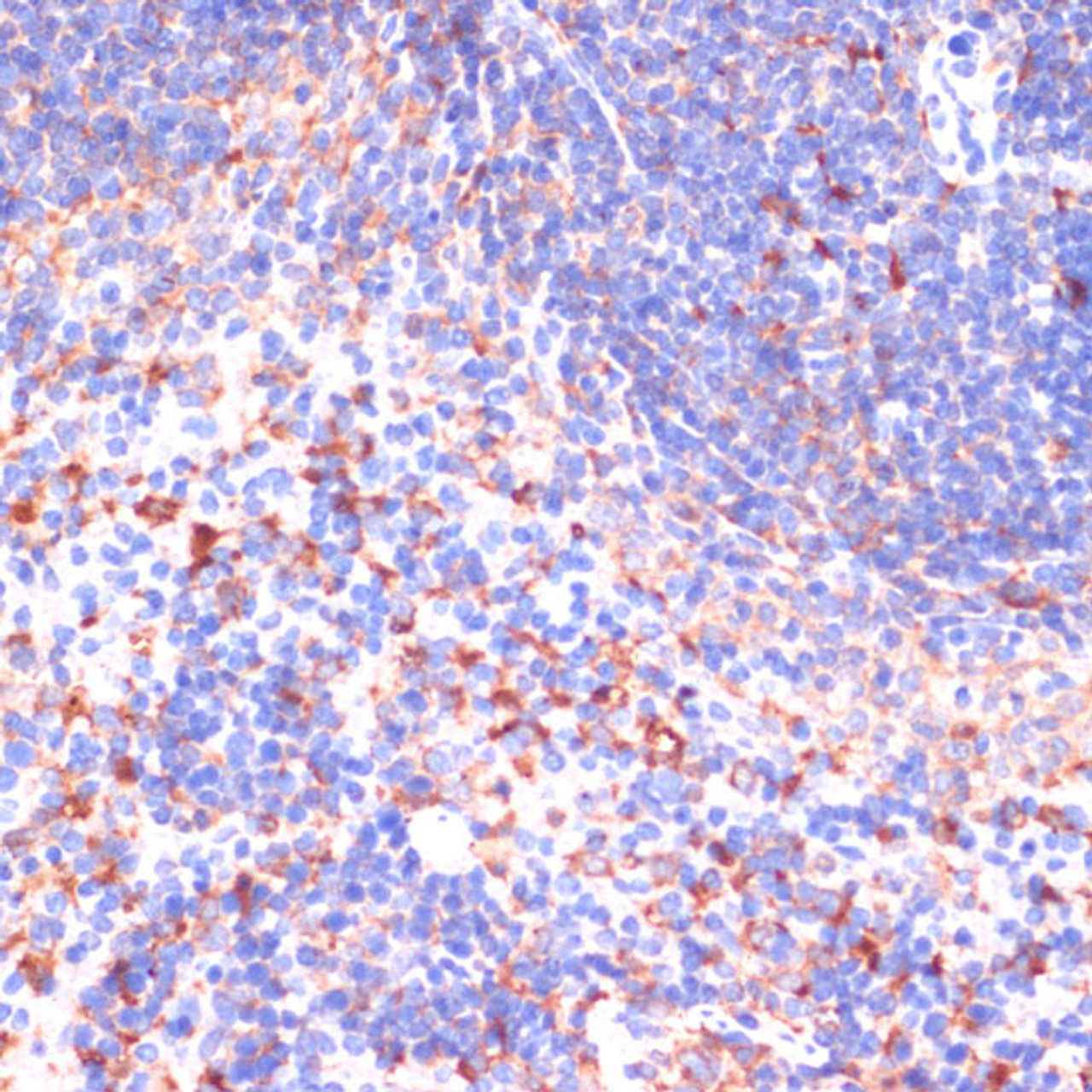 Immunohistochemistry of paraffin-embedded Mouse spleen using VHL Polyclonal Antibody at dilution of  1:200 (40x lens).