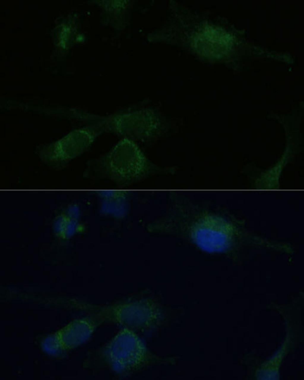 Immunofluorescence analysis of U-251 MG cells using VHL Polyclonal Antibody at dilution of  1:100 (40x lens). Blue: DAPI for nuclear staining.