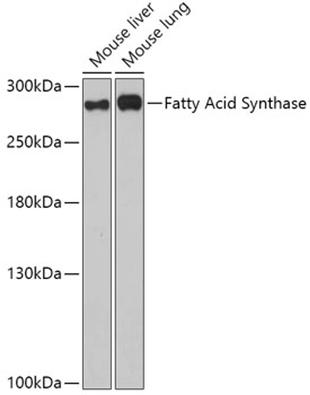 Western blot analysis of extracts of various cell lines using Fatty Acid Synthase Polyclonal Antibody at dilution of 1:1000.