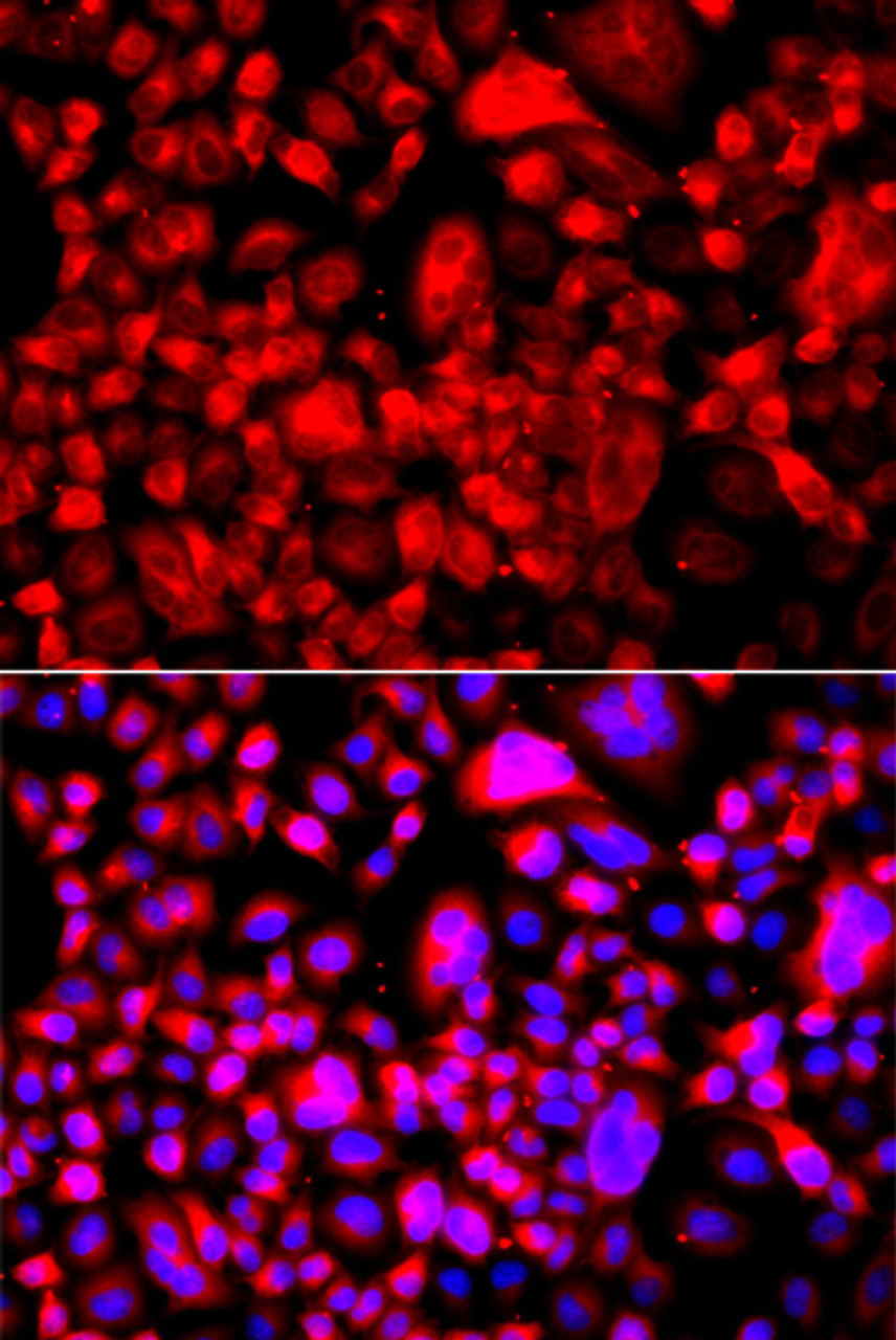 Immunofluorescence analysis of A549 cells using Fatty Acid Synthase Polyclonal Antibody