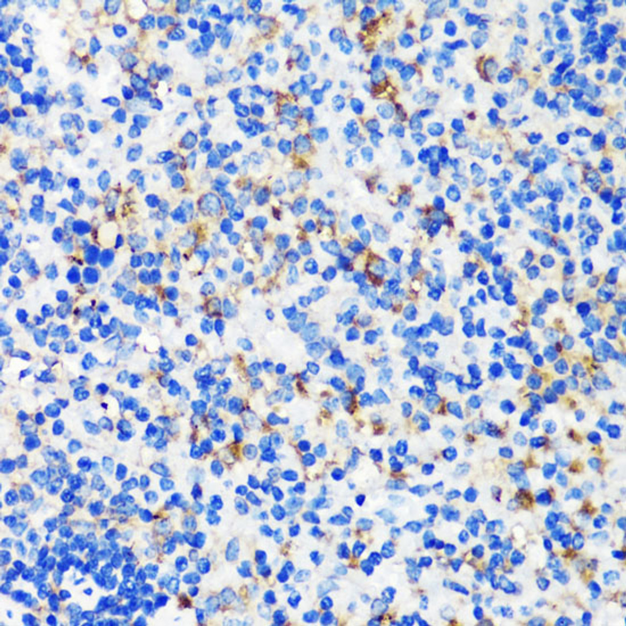 Immunohistochemistry of paraffin-embedded Mouse spleen using TSC2 Polyclonal Antibody at dilution of  1:200 (40x lens).