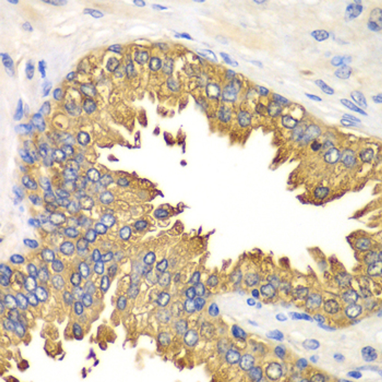 Immunohistochemistry of paraffin-embedded Human prostate using RIG-I / DDX58 Polyclonal Antibody at dilution of  1:100 (40x lens).