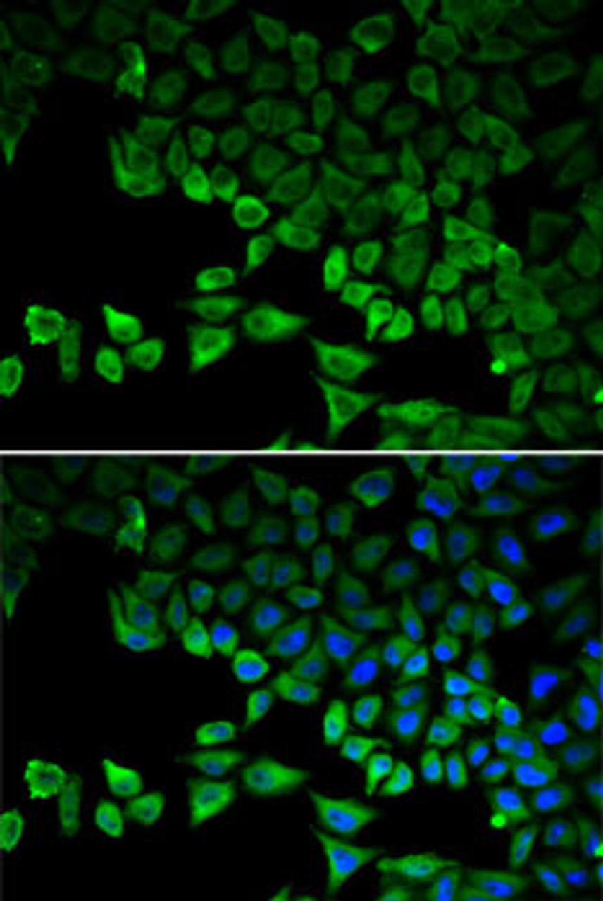 Immunofluorescence analysis of HeLa cells using RIG-I / DDX58 Polyclonal Antibody