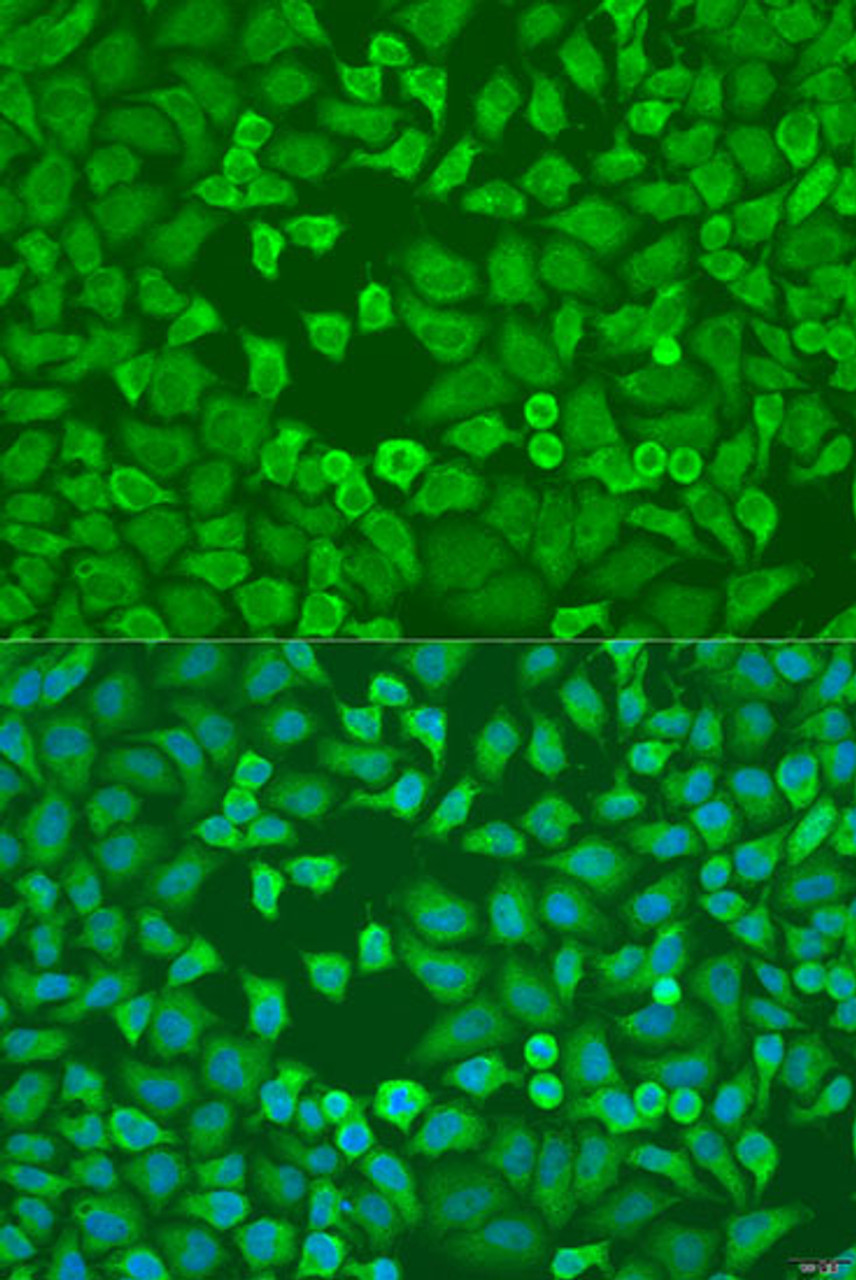 Immunofluorescence analysis of U2OS cells using EIF3A Polyclonal Antibody at dilution of  1:100. Blue: DAPI for nuclear staining.