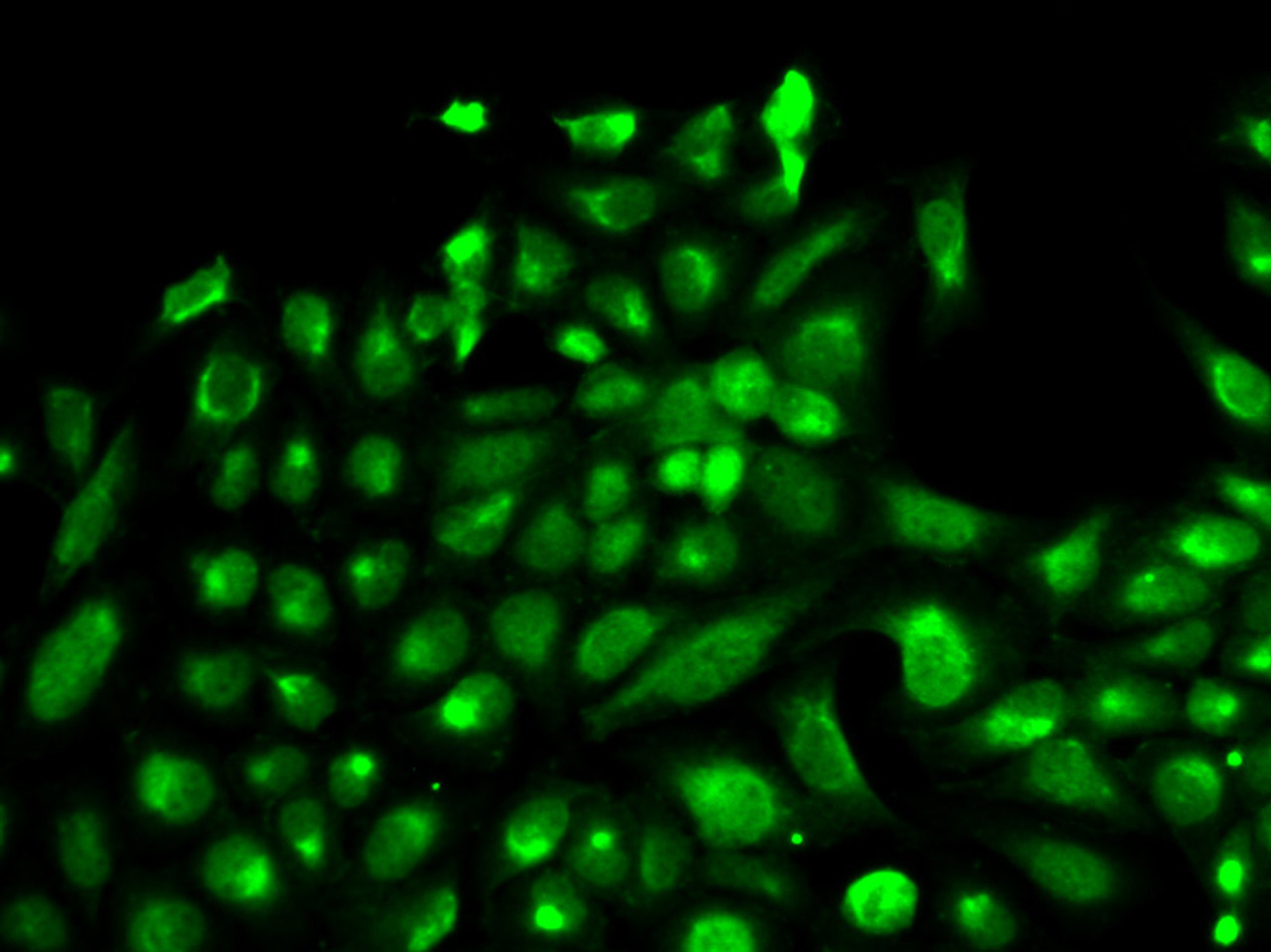 Immunofluorescence analysis of HeLa cells using SPHK1 Polyclonal Antibody