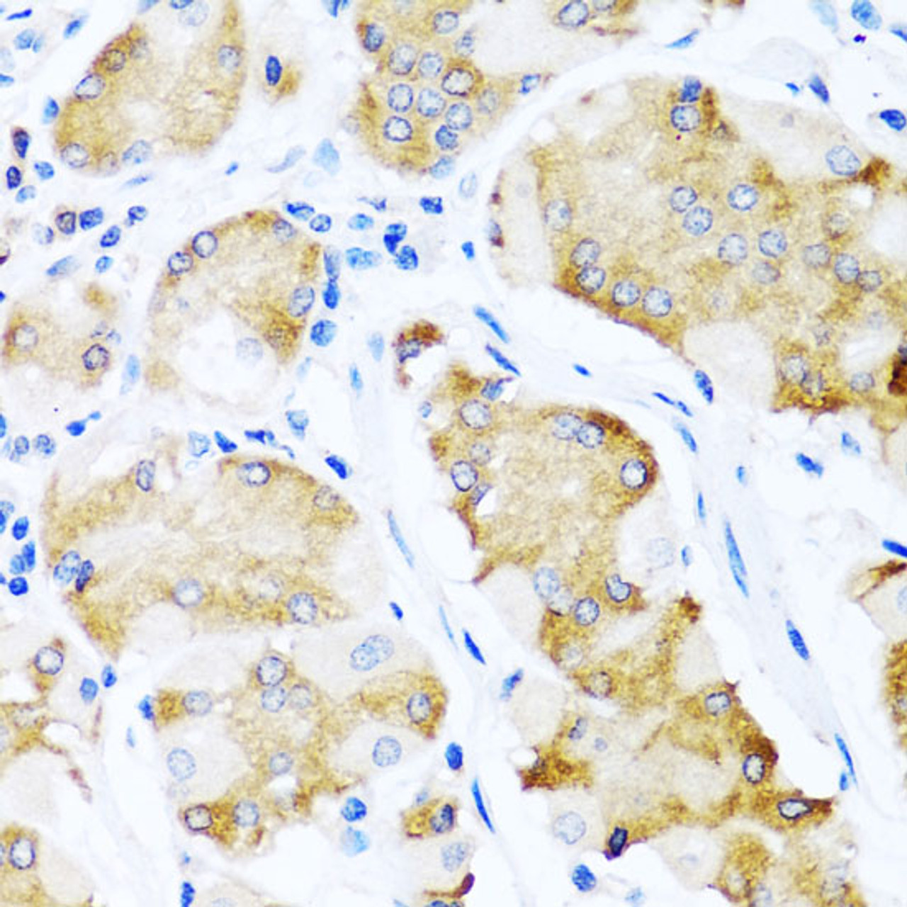 Immunohistochemistry of paraffin-embedded Human stomach using ACVR1C Polyclonal Antibody at dilution of  1:100 (40x lens).