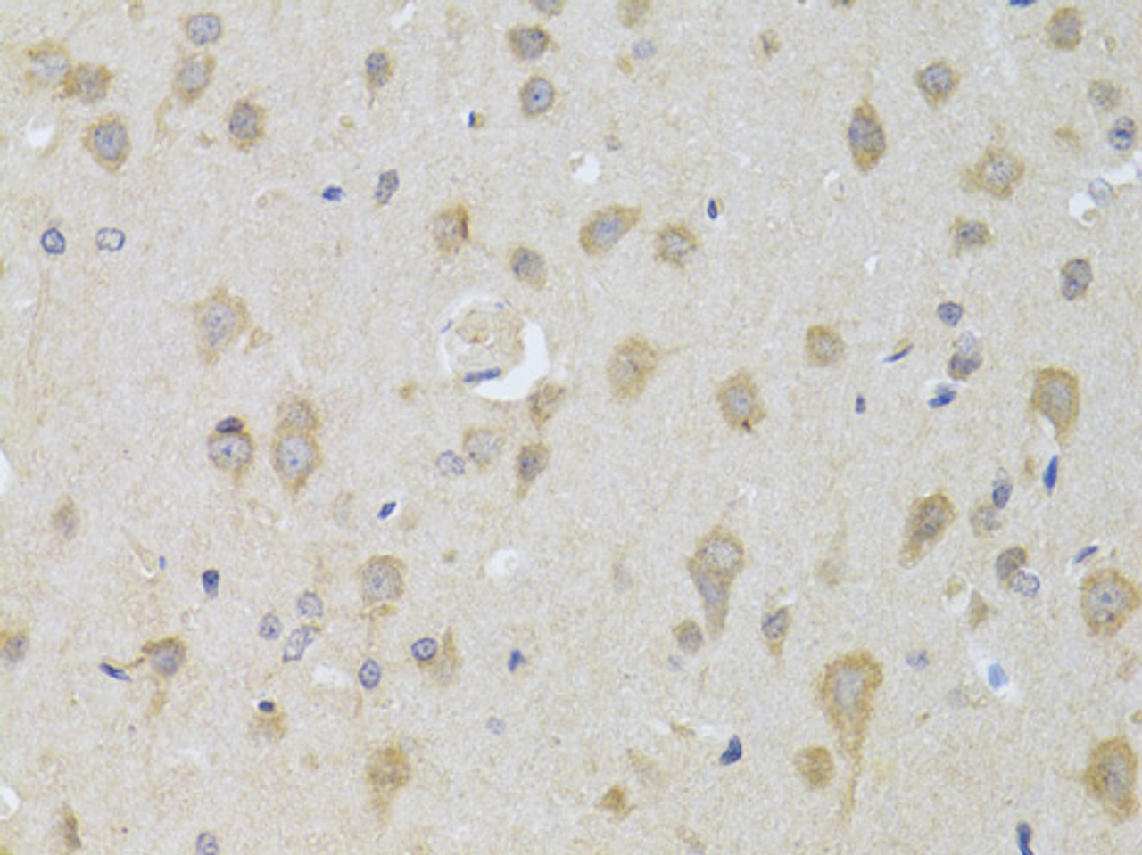 Immunohistochemistry of paraffin-embedded Rat brain using ATG13 Polyclonal Antibody at dilution of  1:100 (40x lens).