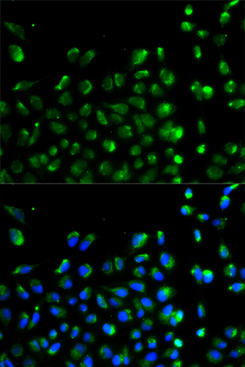 Immunofluorescence analysis of A549 cells using ATG13 Polyclonal Antibody