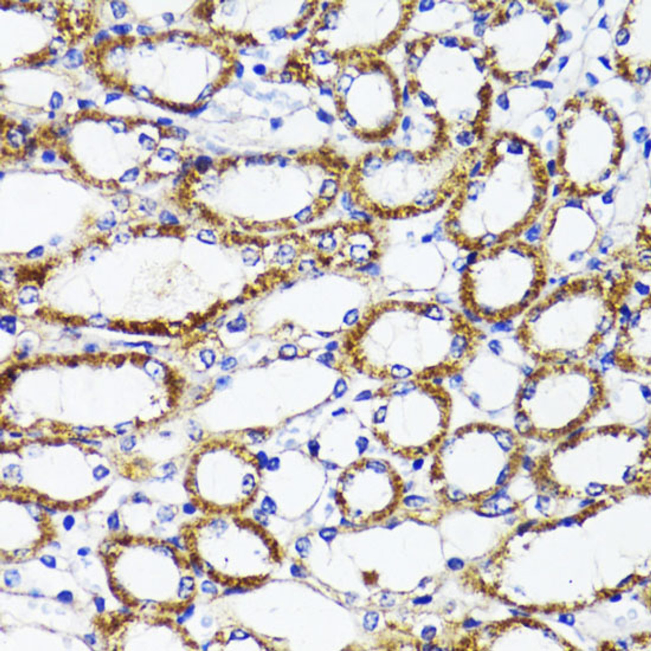 Immunohistochemistry of paraffin-embedded Mouse kidney using SOCS3 Polyclonal Antibody at dilution of  1:100 (40x lens).
