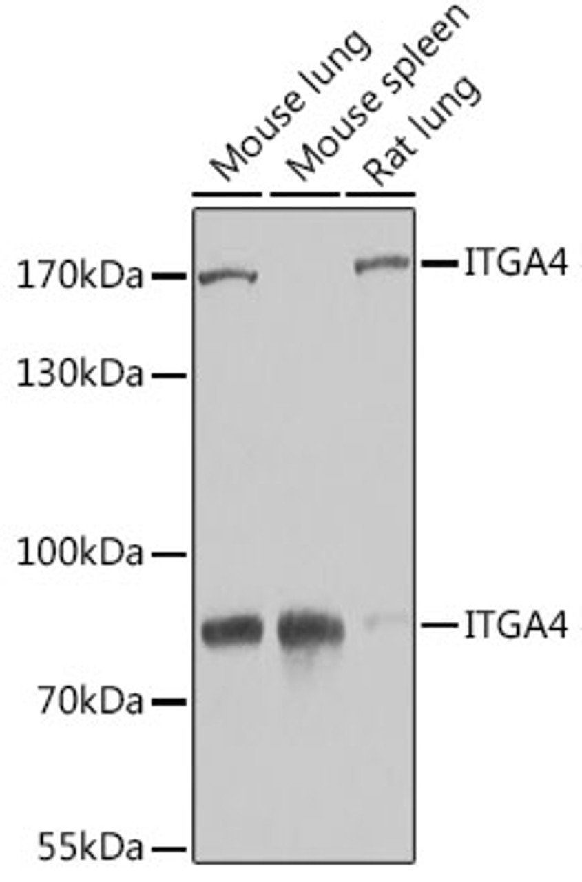 Western blot analysis of extracts of various cell lines using ITGA4 Polyclonal Antibody at dilution of 1:1000.