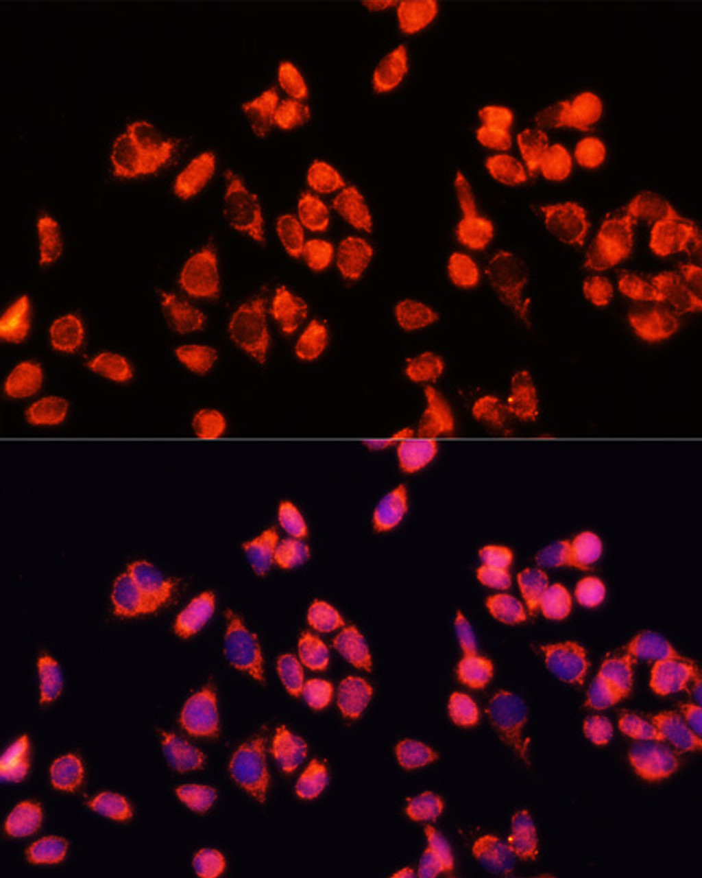 Immunofluorescence analysis of HeLa cells using Angiopoietin 2 Polyclonal Antibody at dilution of  1:100 (40x lens). Blue: DAPI for nuclear staining.