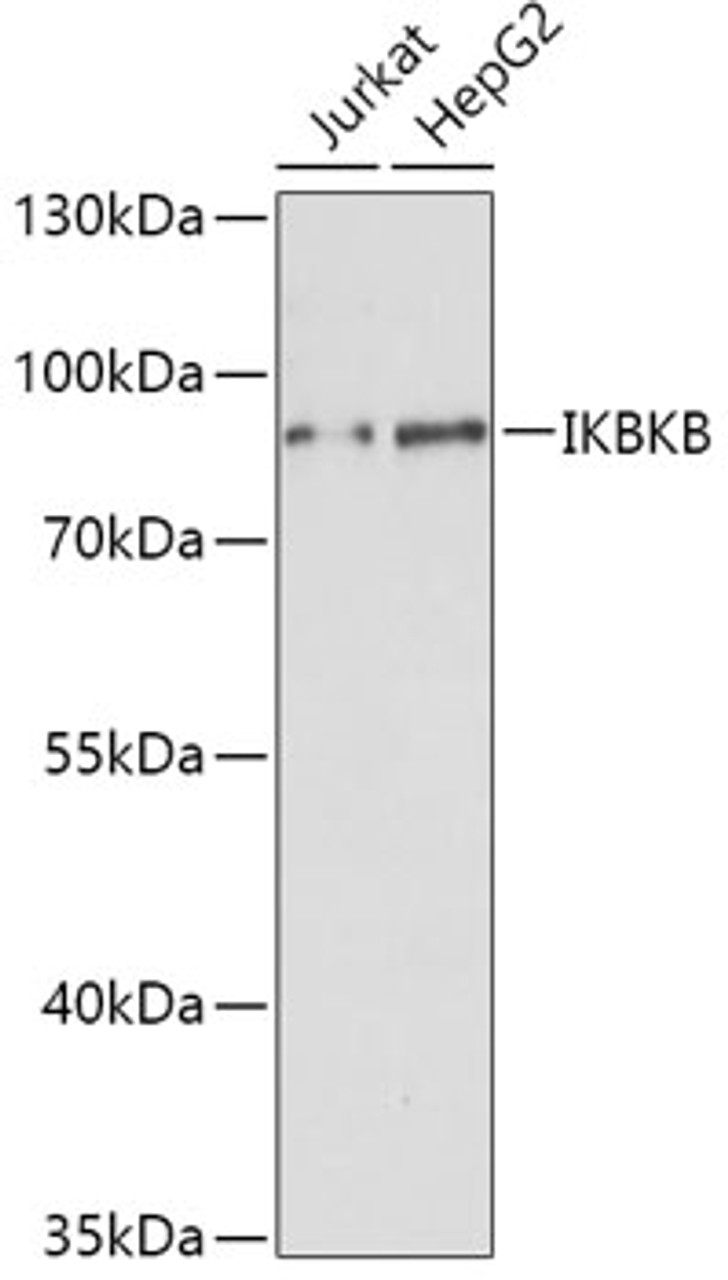 Western blot analysis of extracts of various cell lines using IKK beta Polyclonal Antibody at dilution of 1:1000.