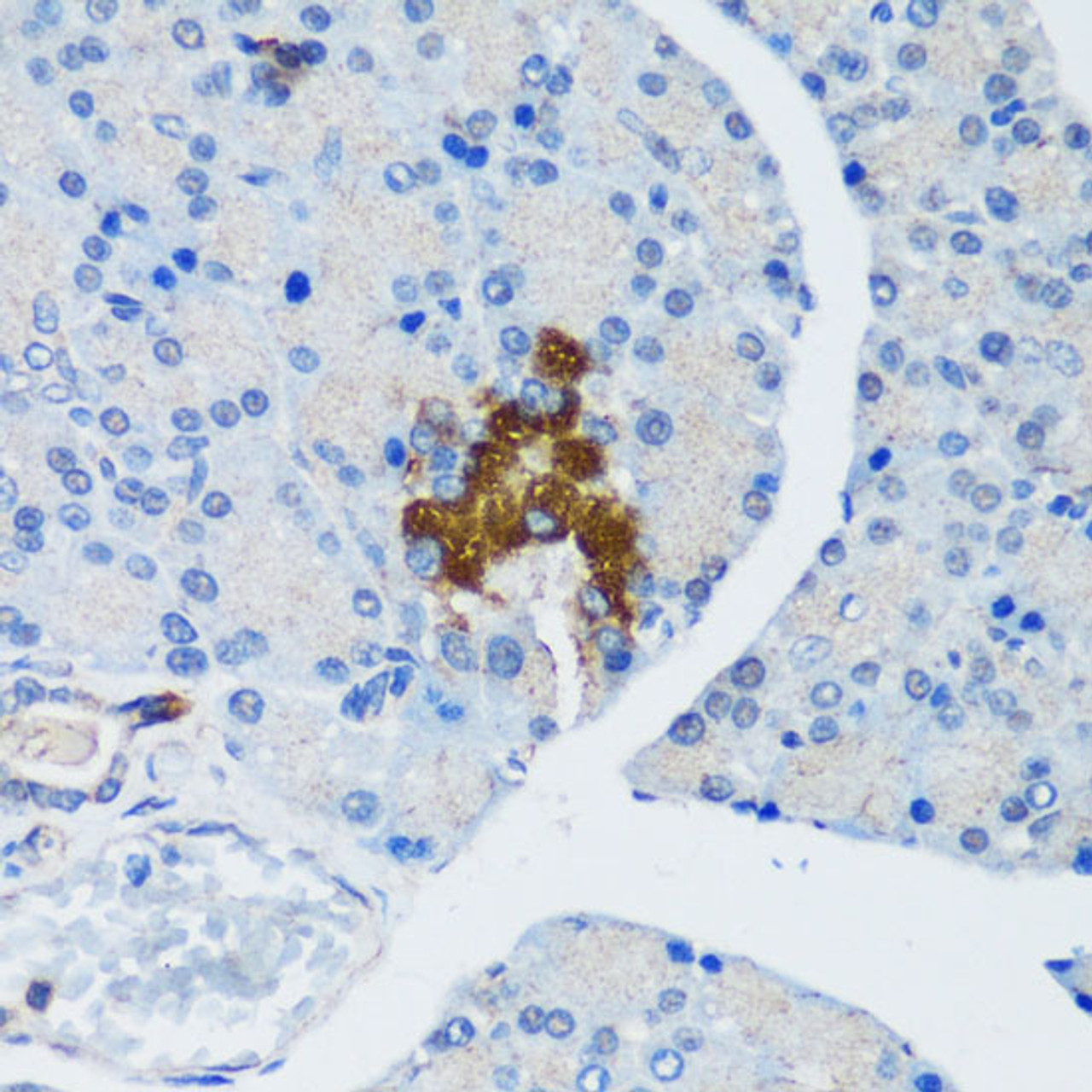 Immunohistochemistry of paraffin-embedded Rat pancreatic islet using TSC1 Polyclonal Antibody at dilution of  1:200 (40x lens).