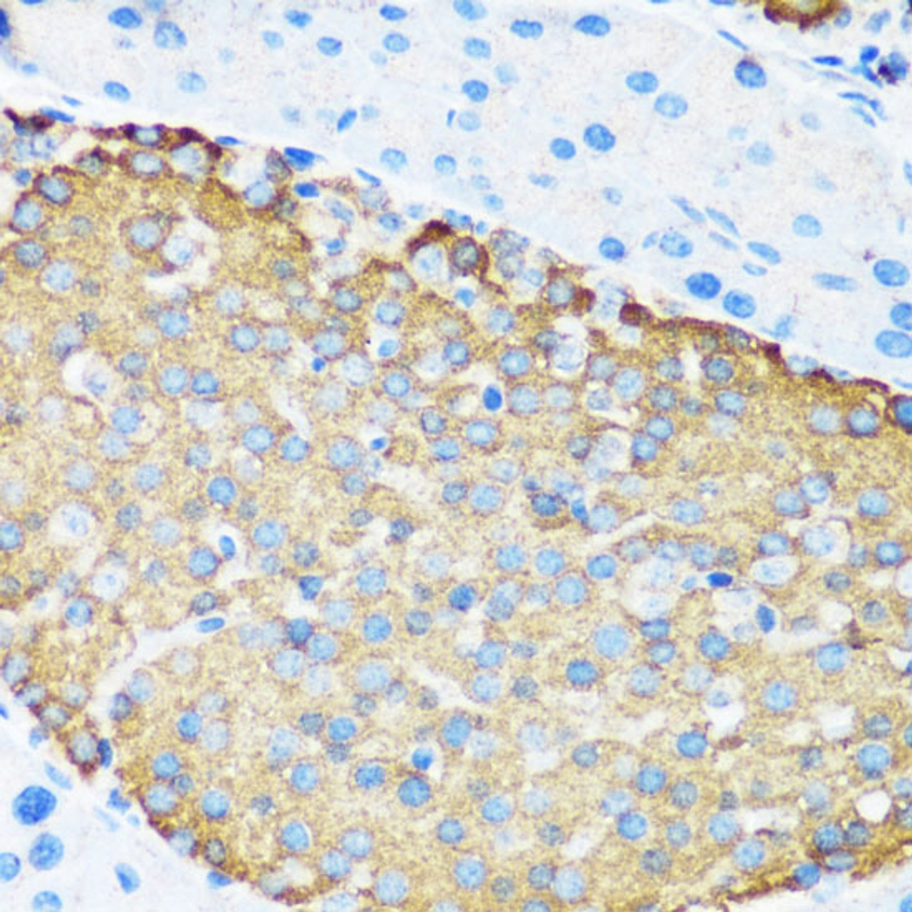 Immunohistochemistry of paraffin-embedded Mouse pancreatic islet using TSC1 Polyclonal Antibody at dilution of  1:200 (40x lens).