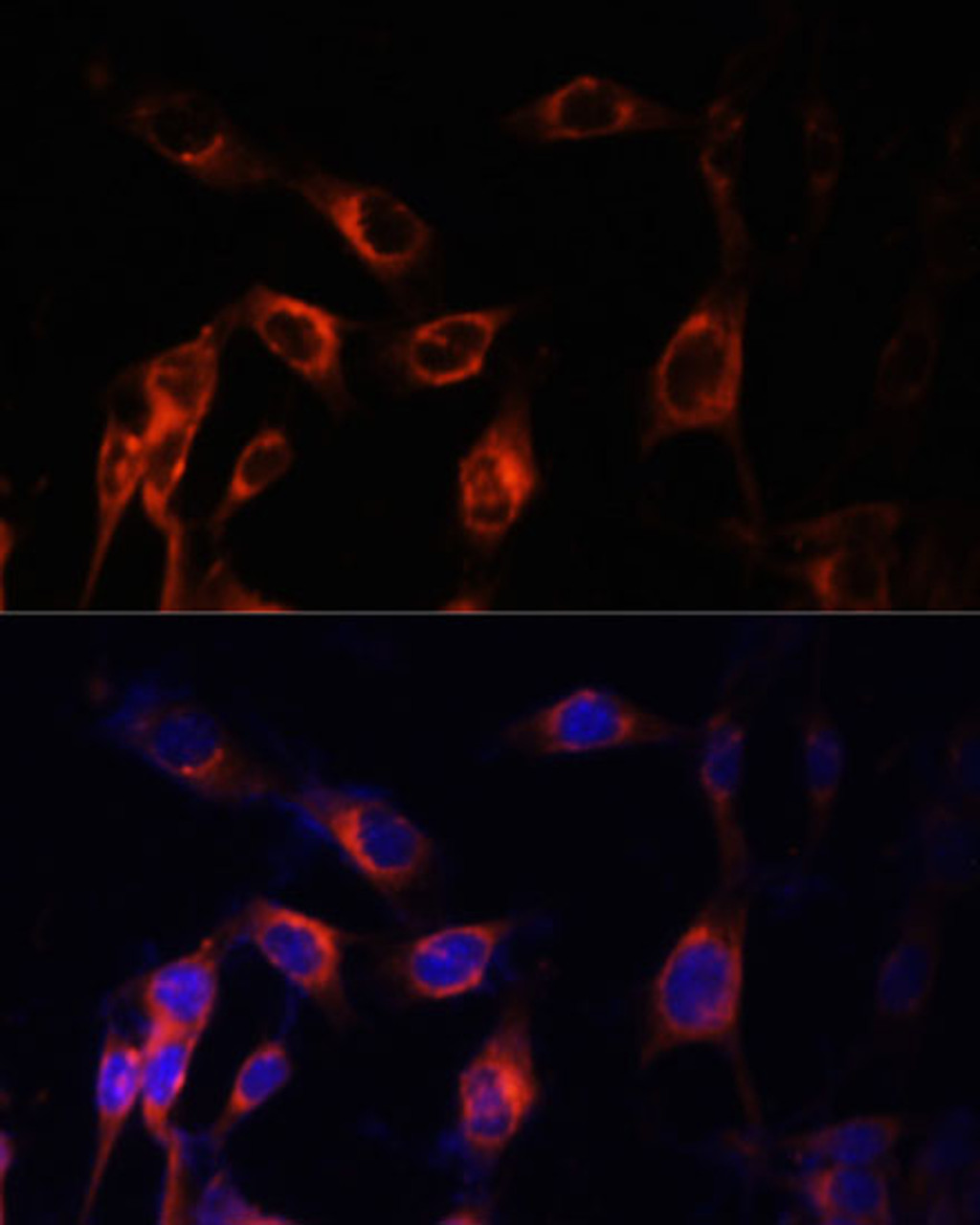 Immunofluorescence analysis of NIH-3T3 cells using TSC1 Polyclonal Antibody at dilution of  1:100 (40x lens). Blue: DAPI for nuclear staining.