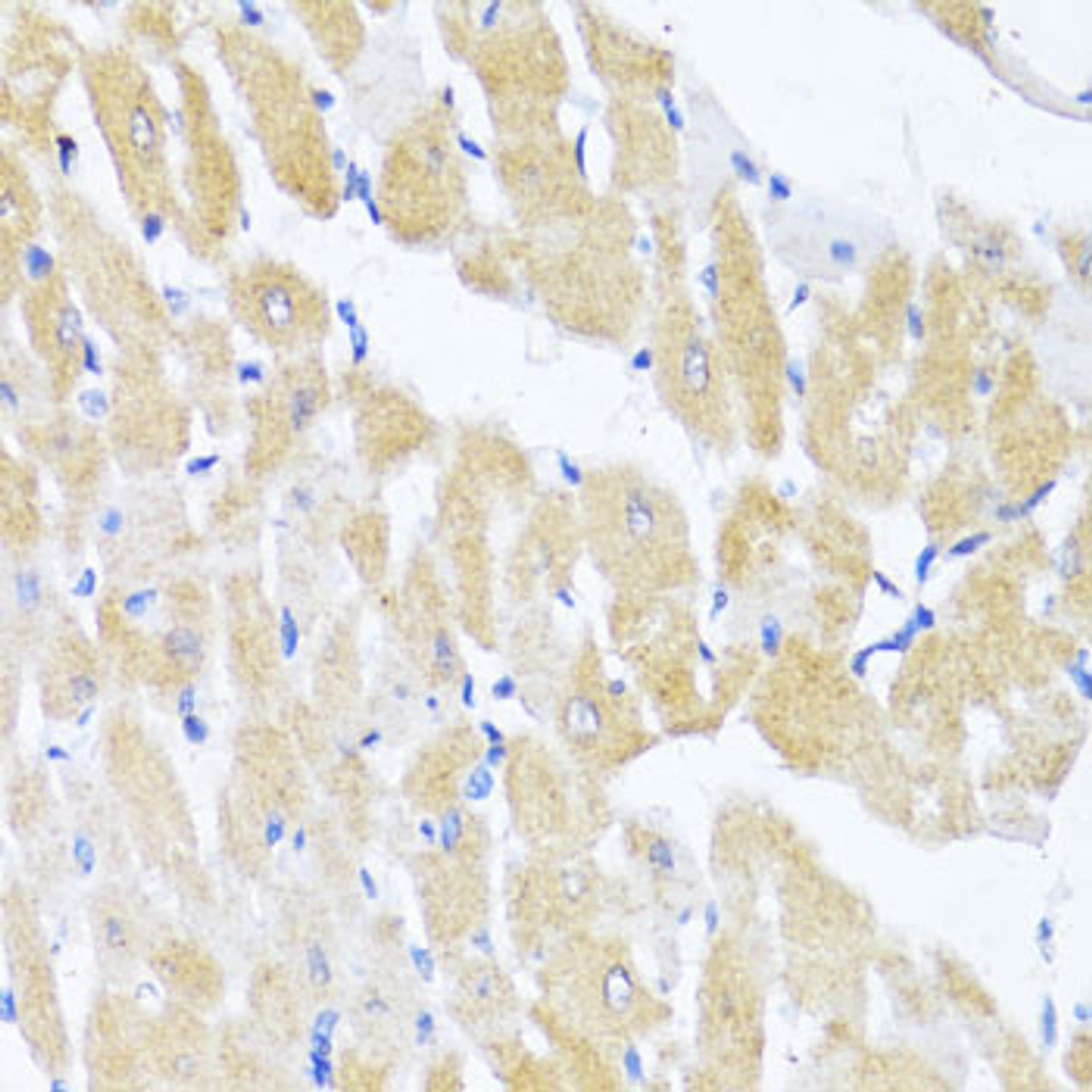 Immunohistochemistry of paraffin-embedded Rat heart using EIF2S1 Polyclonal Antibody at dilution of  1:100 (40x lens).