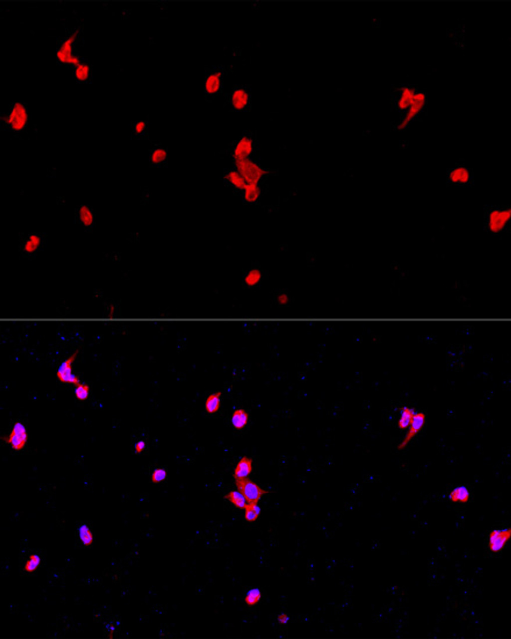 Immunofluorescence analysis of PC-12 cells using EIF2S1 Polyclonal Antibody at dilution of  1:100. Blue: DAPI for nuclear staining.