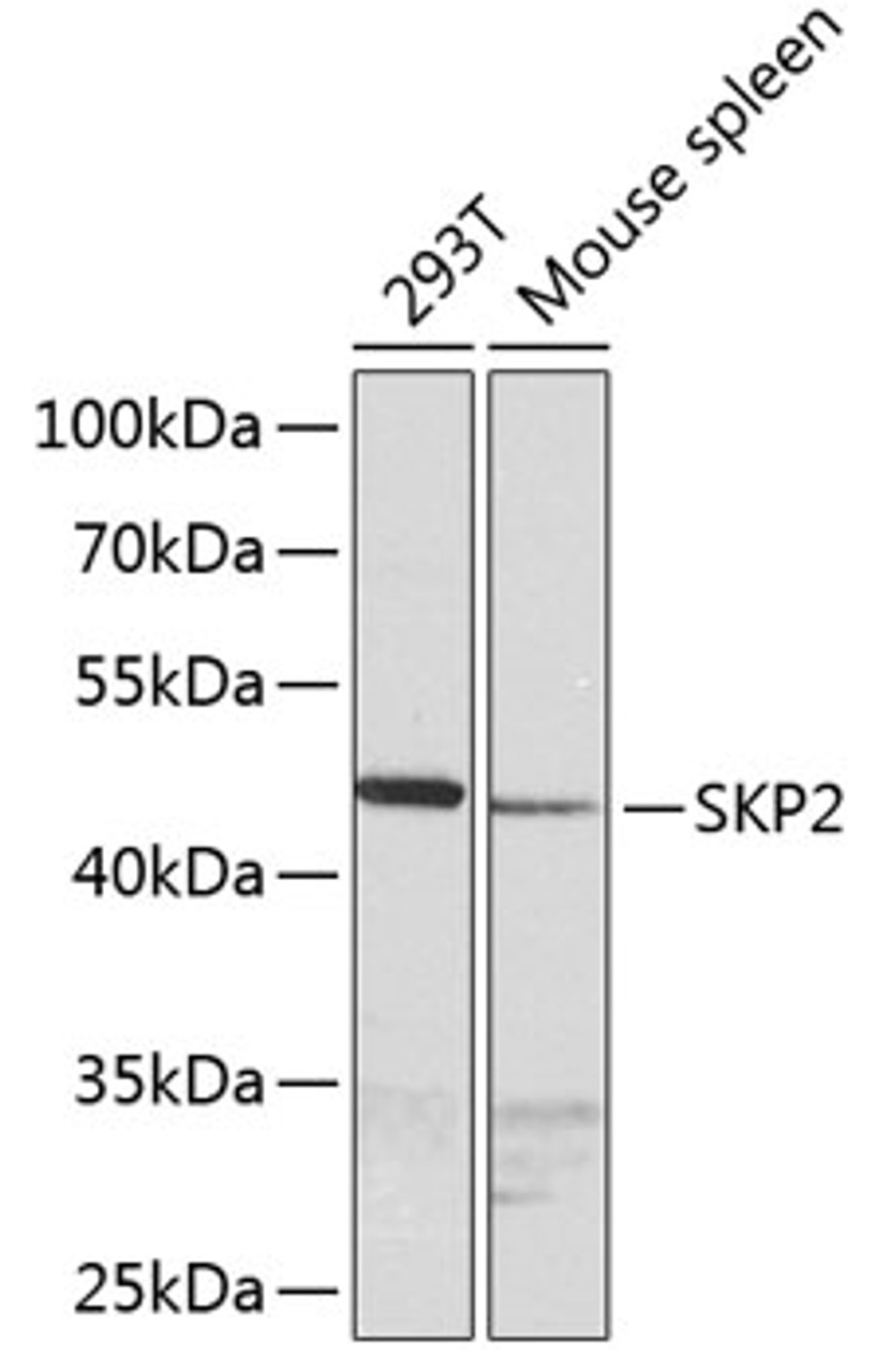 Western blot analysis of extracts of various cell lines using SKP2 Polyclonal Antibody at dilution of 1:1000.
