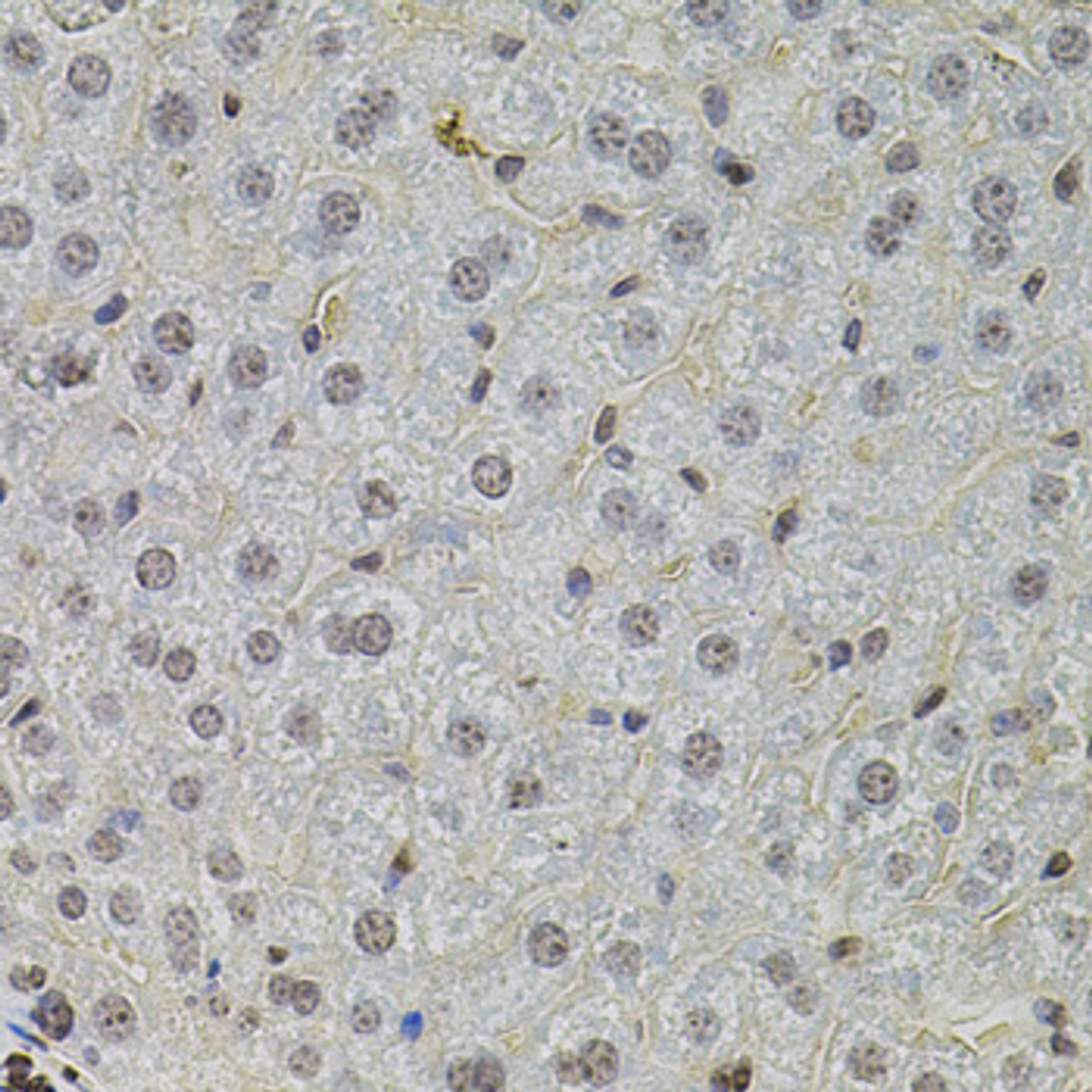 Immunohistochemistry of paraffin-embedded Mouse liver using SKP2 Polyclonal Antibody at dilution of  1:100 (40x lens).