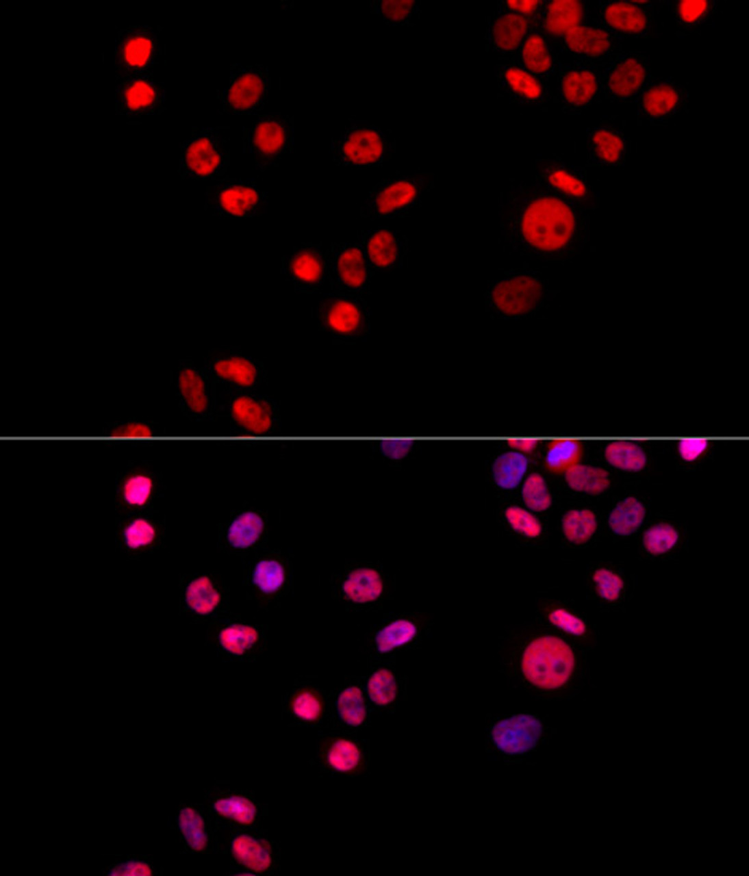 Immunofluorescence analysis of HeLa cells using KU70 Polyclonal Antibody at dilution of  1:100 (40x lens). Blue: DAPI for nuclear staining.