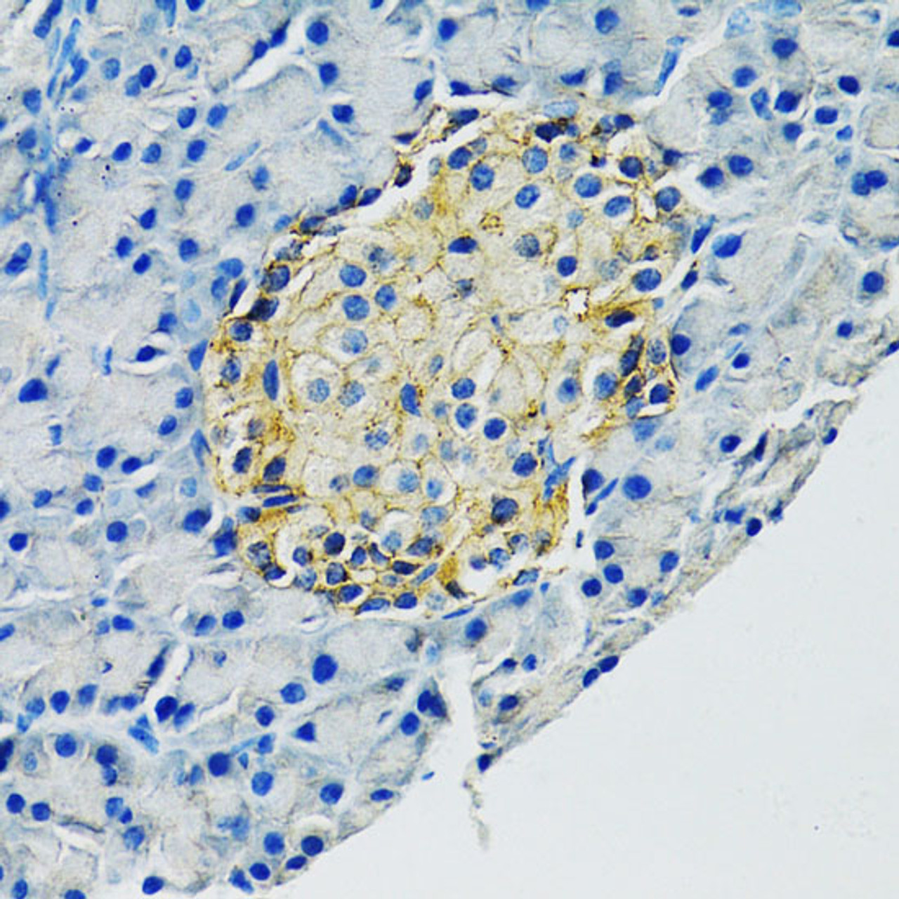 Immunohistochemistry of paraffin-embedded Rat pancreas using SLC1A2 Polyclonal Antibody at dilution of  1:100 (40x lens).