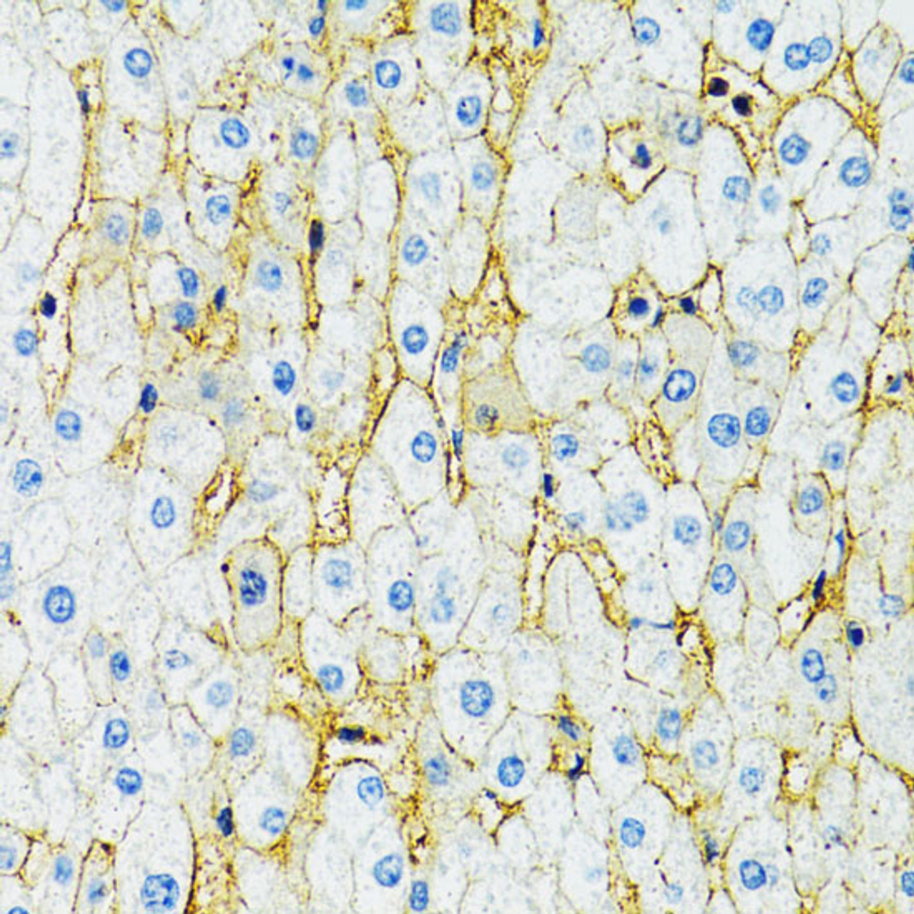 Immunohistochemistry of paraffin-embedded Human liver using SLC1A2 Polyclonal Antibody at dilution of  1:100 (40x lens).
