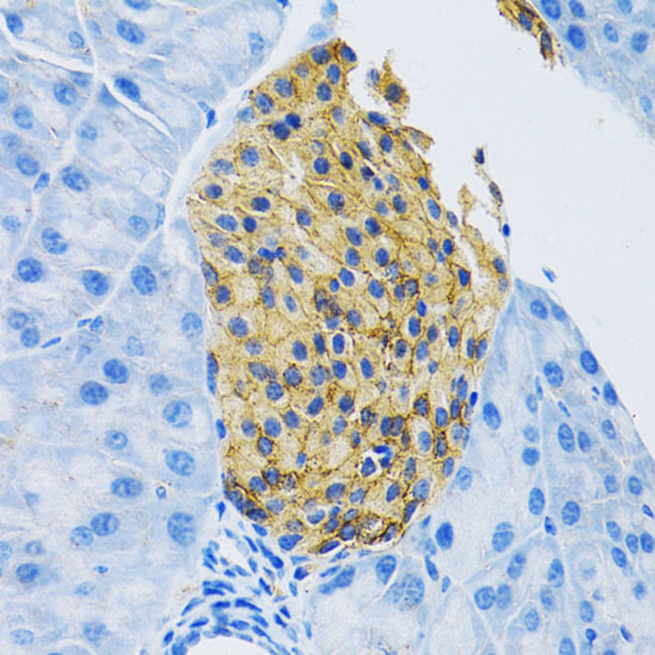 Immunohistochemistry of paraffin-embedded Mouse pancreas using SLC1A2 Polyclonal Antibody at dilution of  1:100 (40x lens).