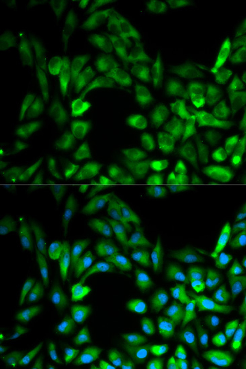 Immunofluorescence analysis of MCF-7 cells using IKBKG Polyclonal Antibody