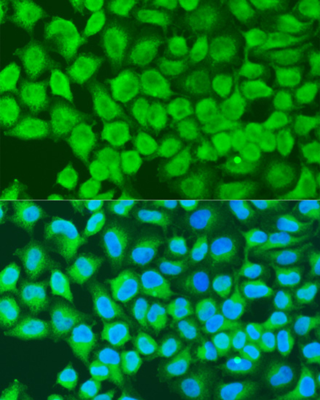 Immunofluorescence analysis of U2OS cells using MAP3K7 Polyclonal Antibody at dilution of  1:100. Blue: DAPI for nuclear staining.