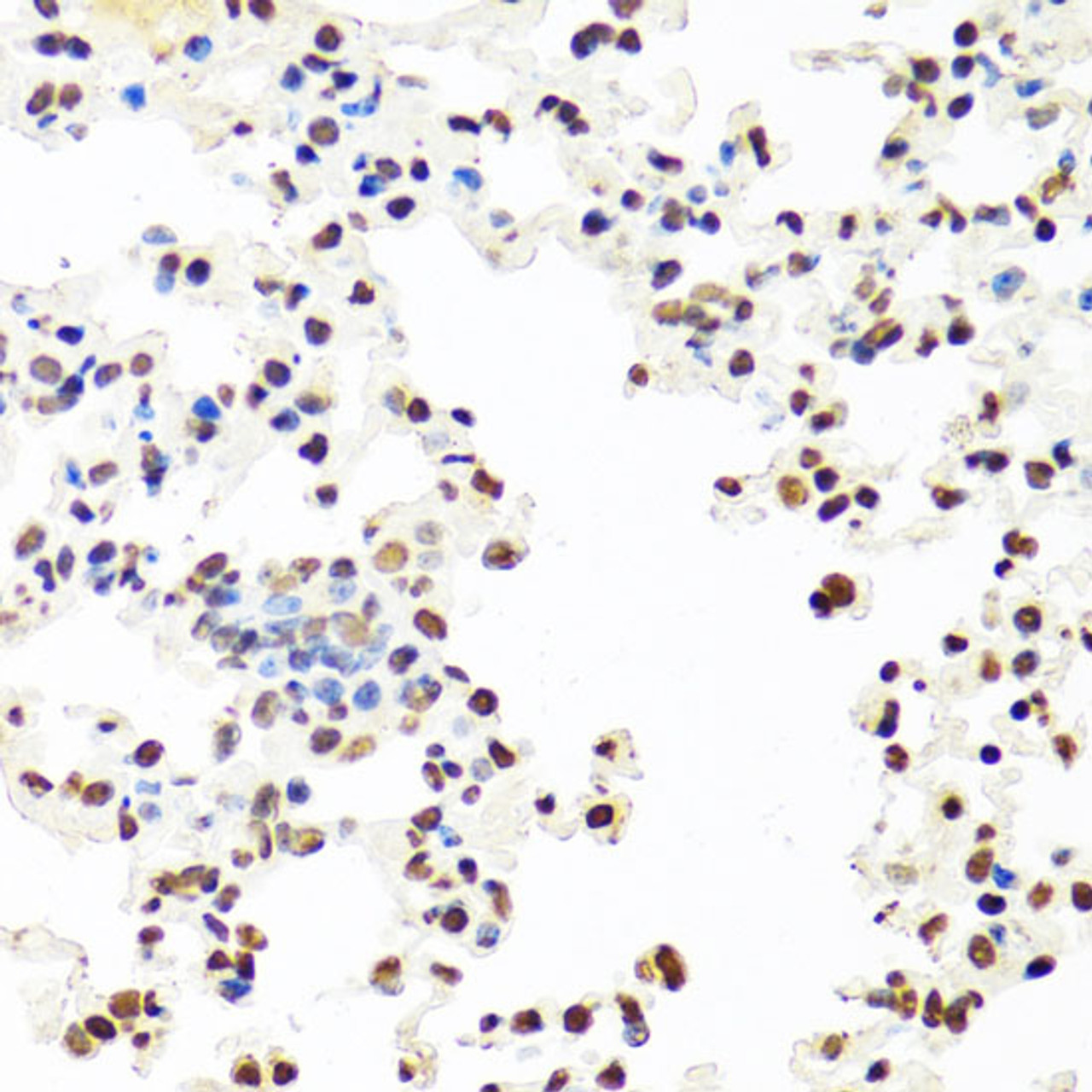 Immunohistochemistry of paraffin-embedded Mouse lung using SFPQ Polyclonal Antibody at dilution of  1:100 (40x lens).