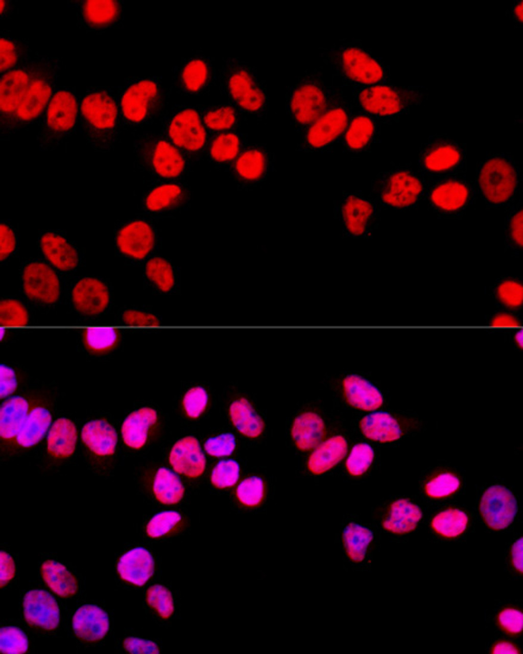 Immunofluorescence analysis of HeLa cells using SFPQ Polyclonal Antibody at dilution of  1:100 (40x lens). Blue: DAPI for nuclear staining.