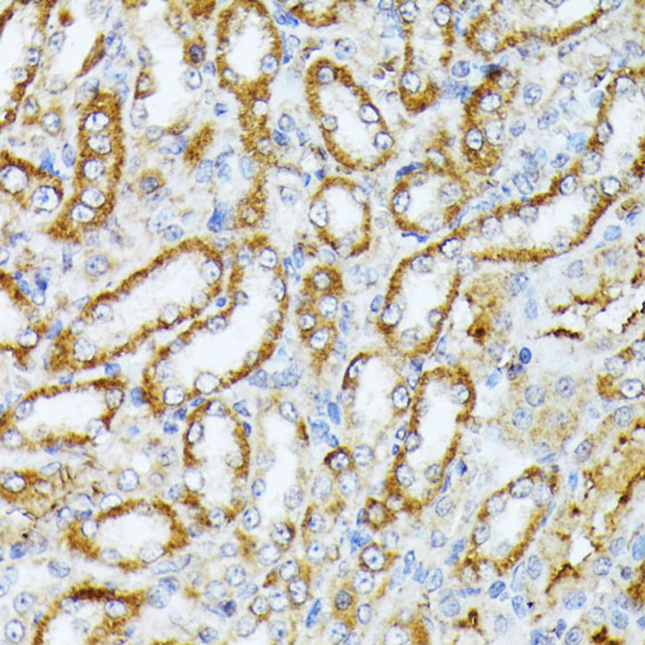 Immunohistochemistry of paraffin-embedded Rat kidney using Caspase-1 Polyclonal Antibody at dilution of  1:100 (40x lens).