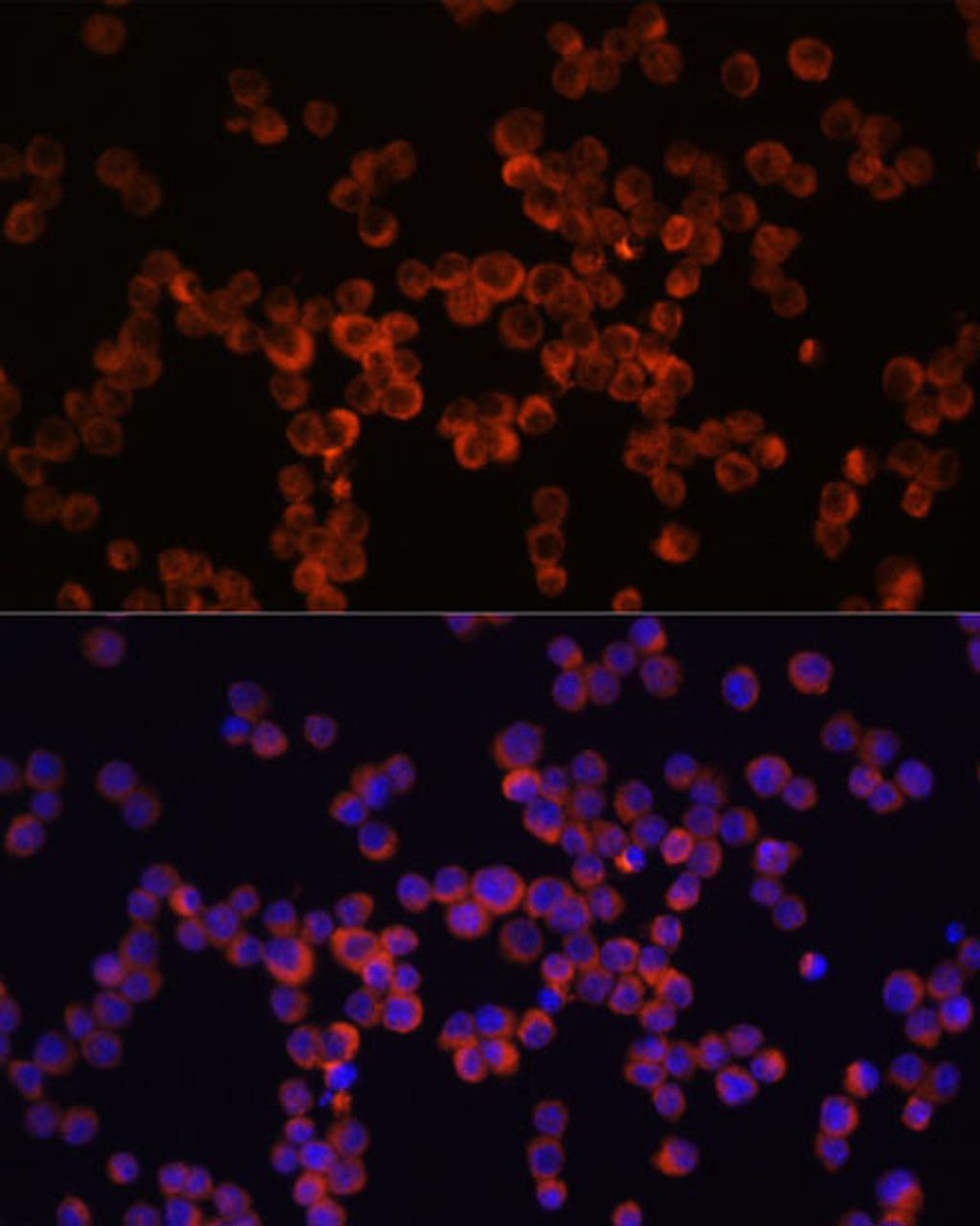 Immunofluorescence analysis of Raw264.7 cells using Caspase-1 Polyclonal Antibody at dilution of  1:100 (40x lens). Blue: DAPI for nuclear staining.