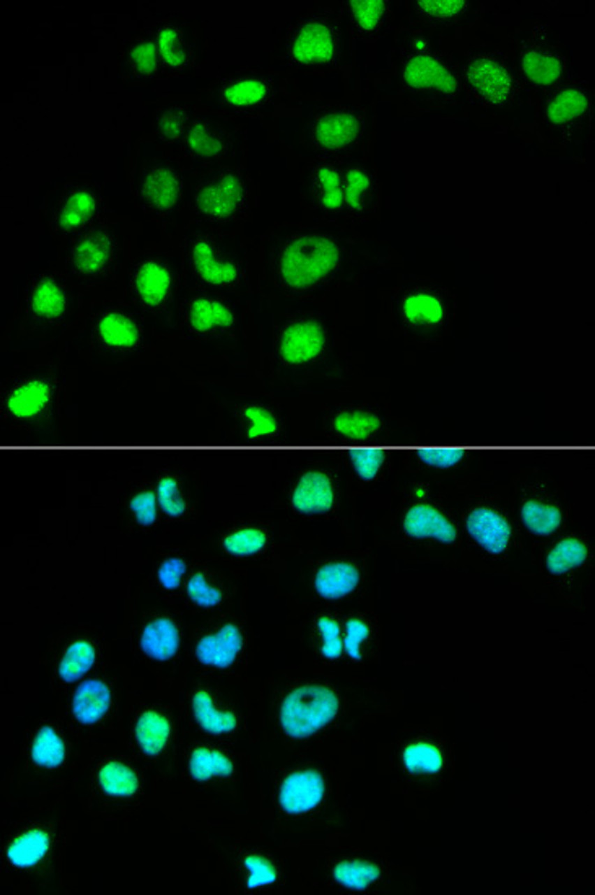 Immunofluorescence analysis of HeLa cells using MSH6 Polyclonal Antibody