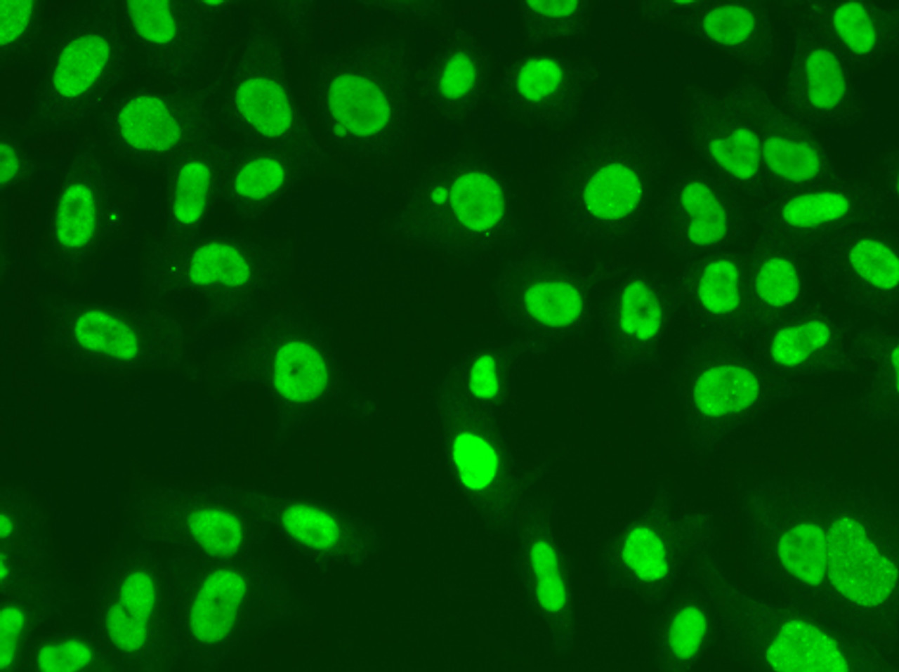 Immunofluorescence analysis of A549 cells using MSH6 Polyclonal Antibody