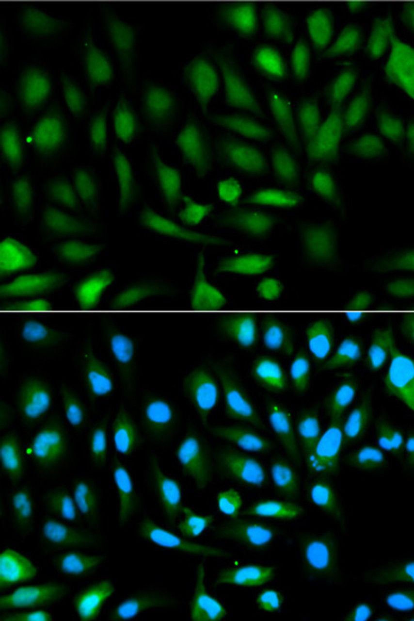 Immunofluorescence analysis of HeLa cells using PARK7 Polyclonal Antibody