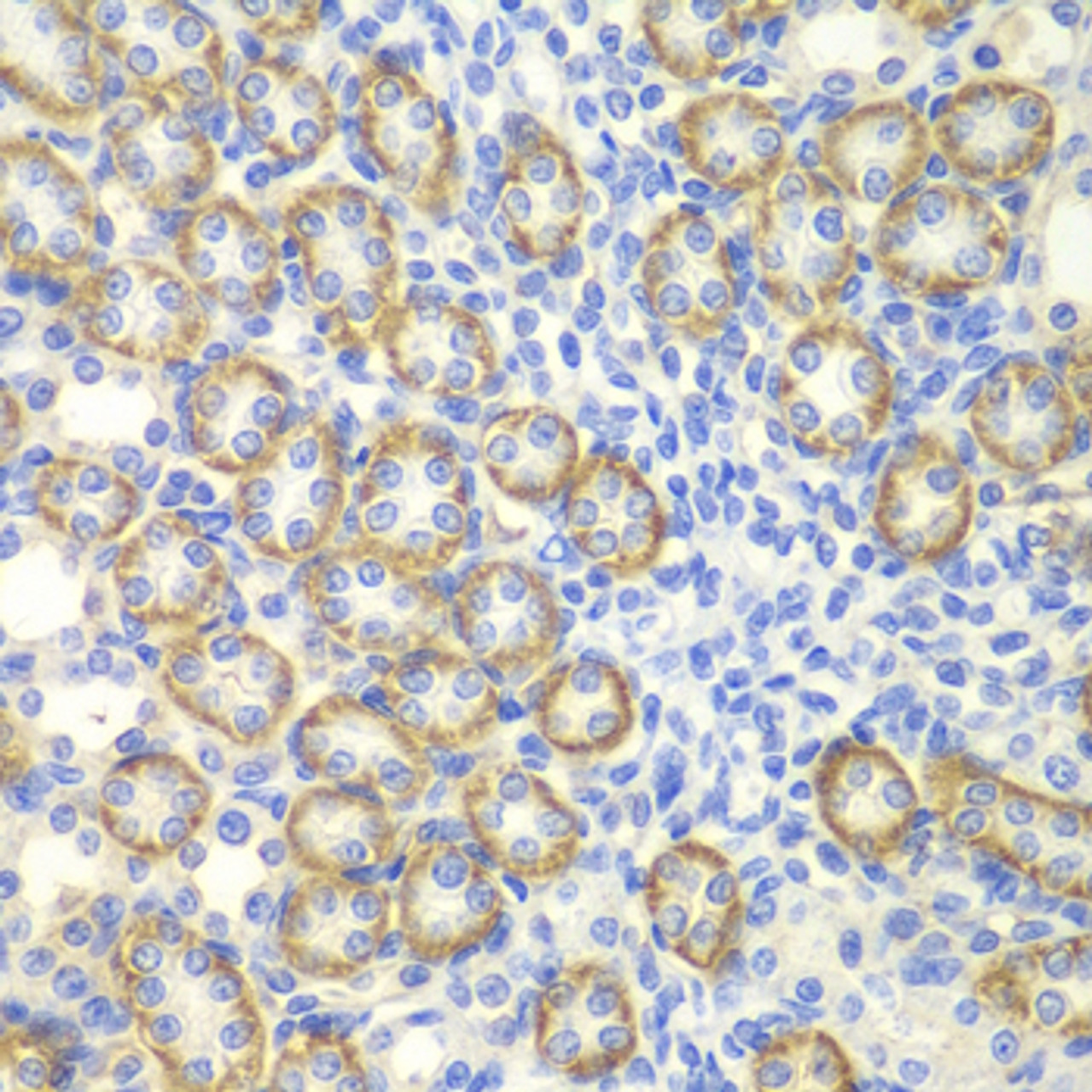 Immunohistochemistry of paraffin-embedded Rat kidney using SYT1 Polyclonal Antibody at dilution of  1:200 (40x lens).