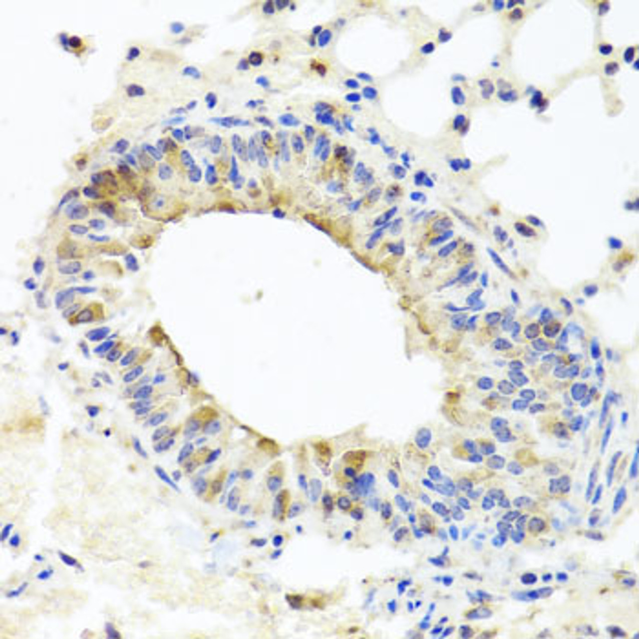 Immunohistochemistry of paraffin-embedded Mouse lung using MUC16 Polyclonal Antibody at dilution of  1:100 (40x lens).