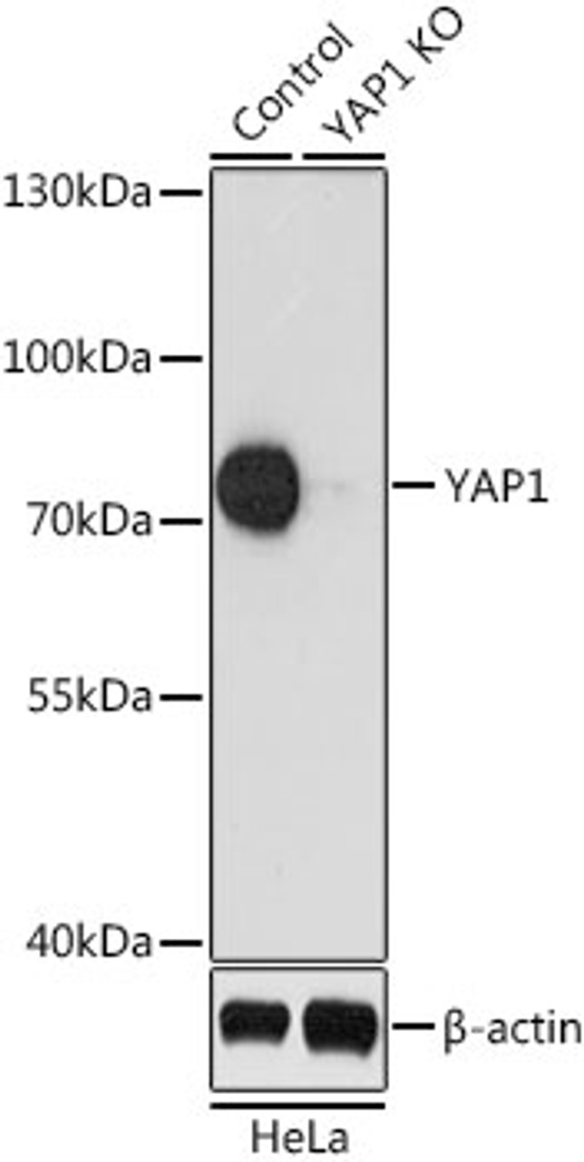 Western blot analysis of extracts from normal (control) and YAP1 knockout (KO) HeLa cells using YAP1 Polyclonal Antibody at dilution of 1:1000.
