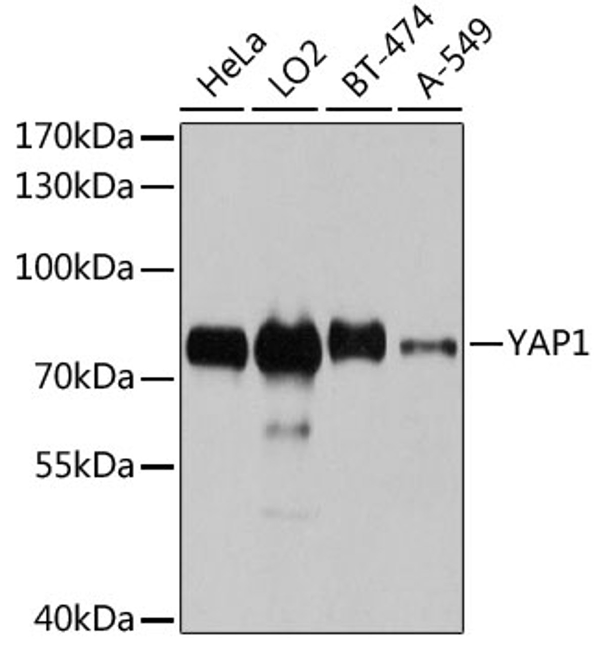 Western blot analysis of extracts of various cell lines using YAP1 Polyclonal Antibody at dilution of 1:1000.