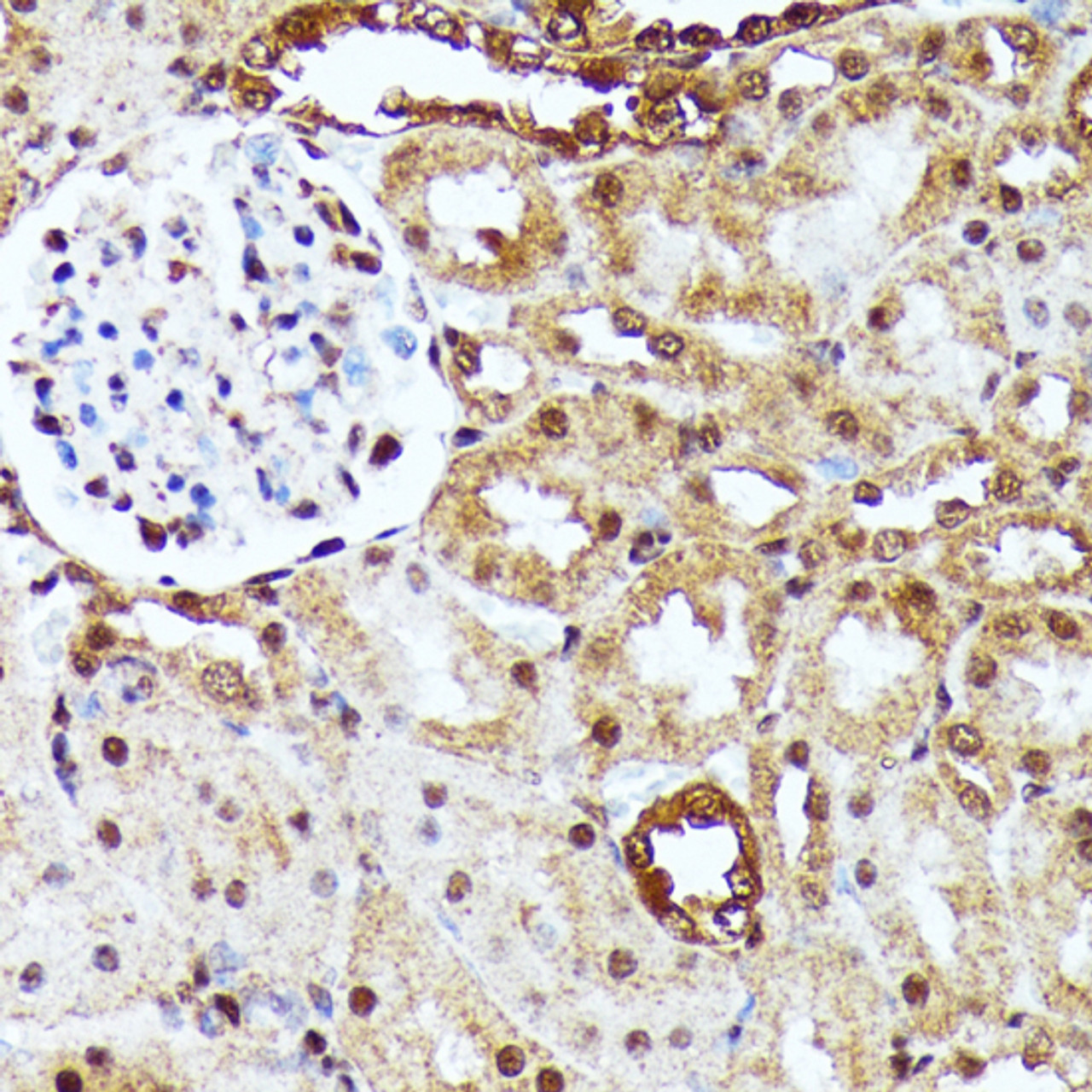 Immunohistochemistry of paraffin-embedded Rat kidney using YAP1 Polyclonal Antibody at dilution of  1:100 (40x lens).