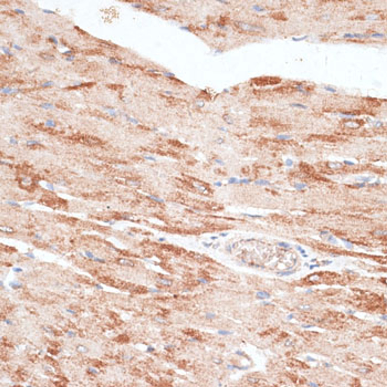 Immunohistochemistry of paraffin-embedded Rat heart using KIR3DL3 Polyclonal Antibody at dilution of  1:100 (40x lens).