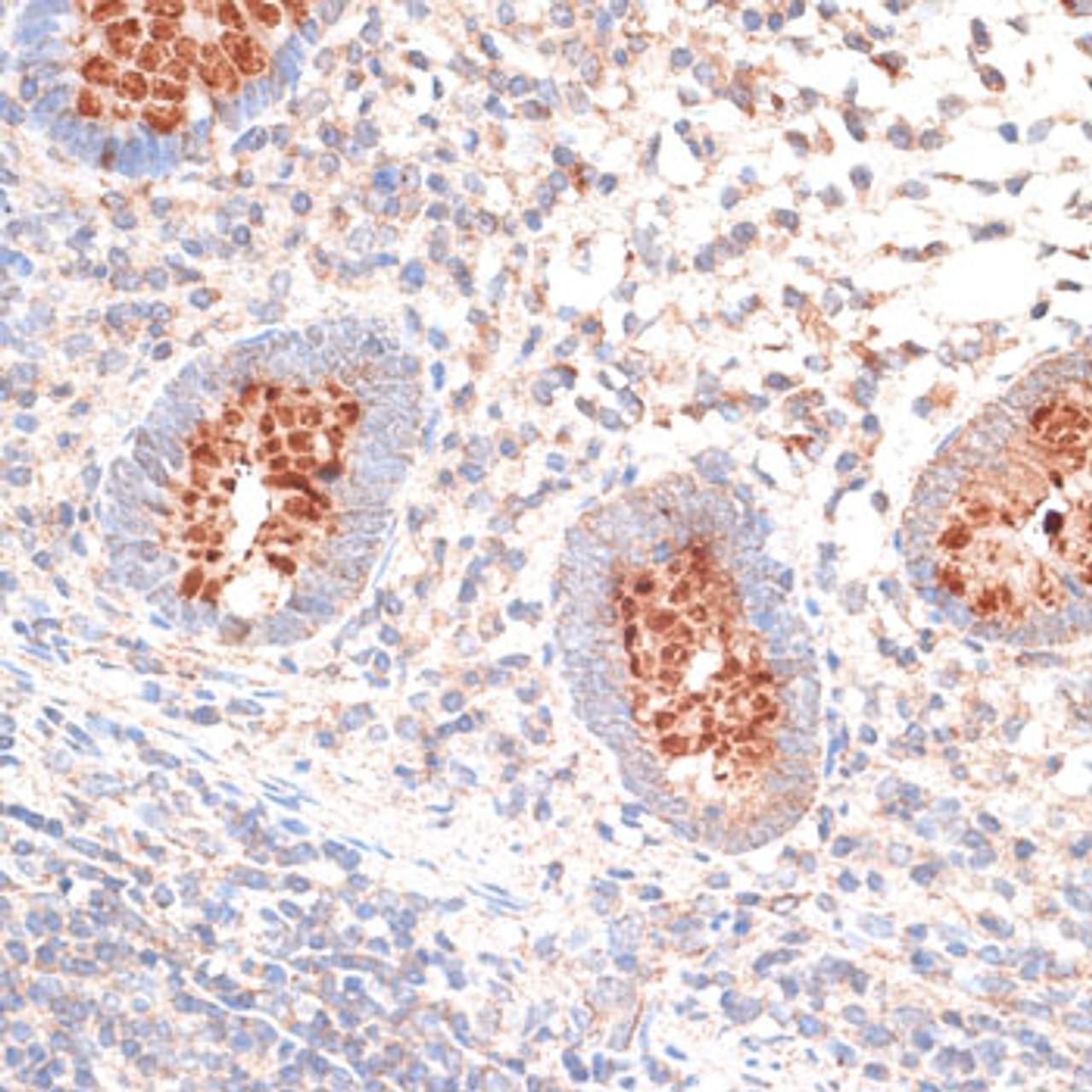 Immunohistochemistry of paraffin-embedded Human appendix using KIR3DL3 Polyclonal Antibody at dilution of  1:100 (40x lens).