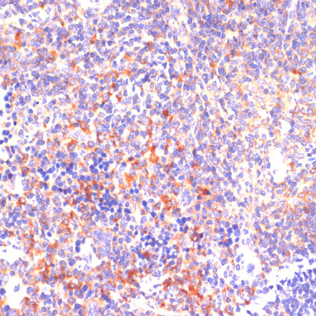 Immunohistochemistry of paraffin-embedded Mouse spleen using ROCK1 Polyclonal Antibody at dilution of  1:100 (40x lens).